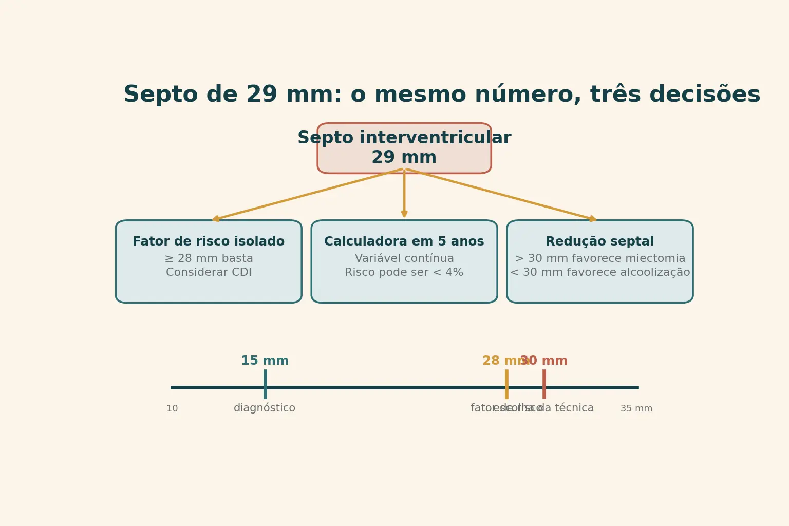 Esquema com um septo de 29 mm no topo e três setas para três destinos, com uma régua de limiares desiguais em 15, 28 e 30 mm embaixo.