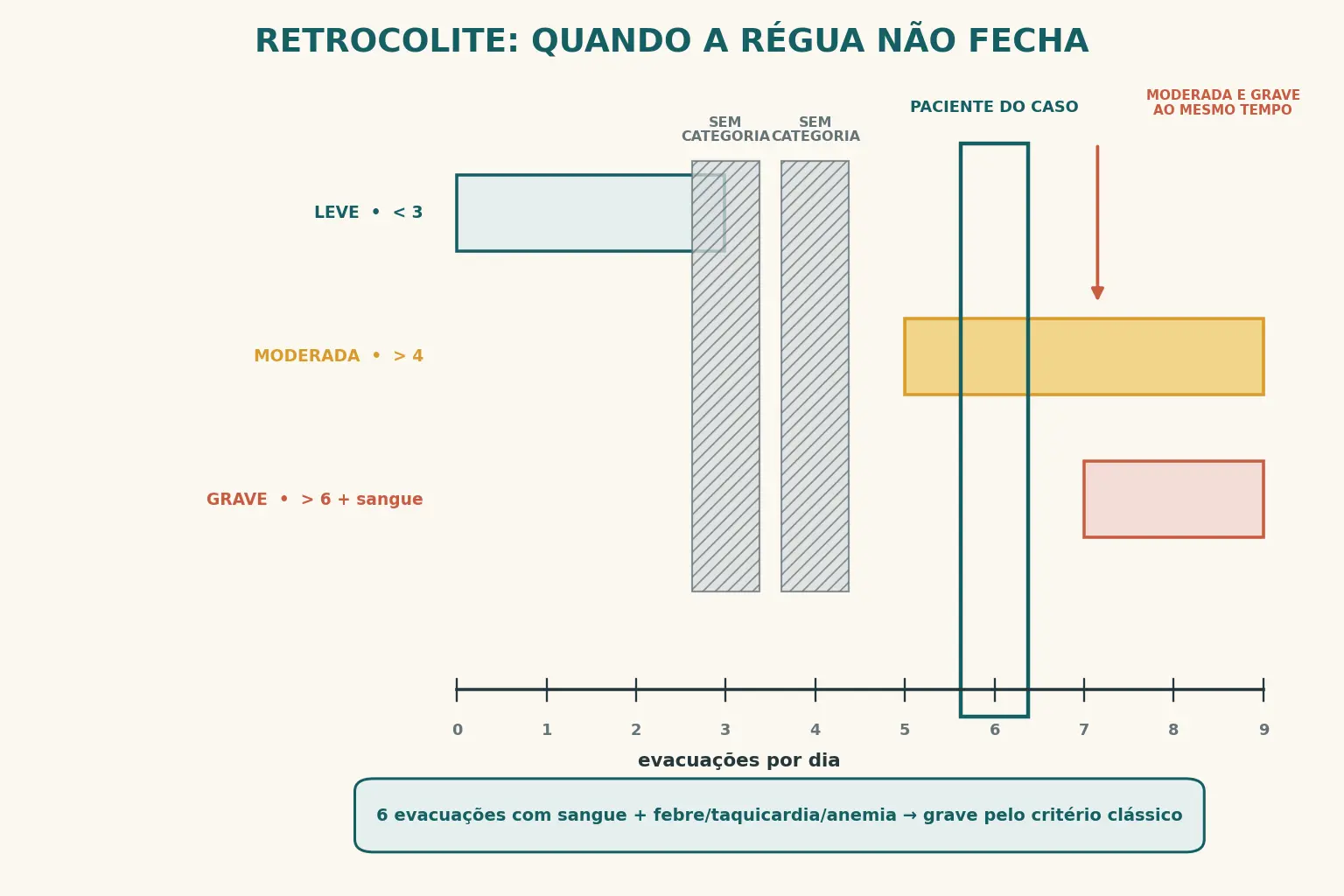 Reta numérica de evacuações por dia, de 0 a 9, com quatro barras. A faixa leve cobre de 0 a 2, a moderada começa em 5, a grave começa em 7 e o critério clássico, desenhado abaixo do eixo, começa em 6. As posições 3 e 4 ficam sem barra nenhuma, marcadas como sem categoria, e de 7 em diante moderada e grave se sobrepõem. Um marcador sobre o 6 descreve paciente com 6 evacuações com sangue, temperatura 38,2 graus, frequência cardíaca 96 e hemoglobina 9,8, classificado como colite aguda grave pelo critério clássico e no máximo moderada pela letra do texto brasileiro.