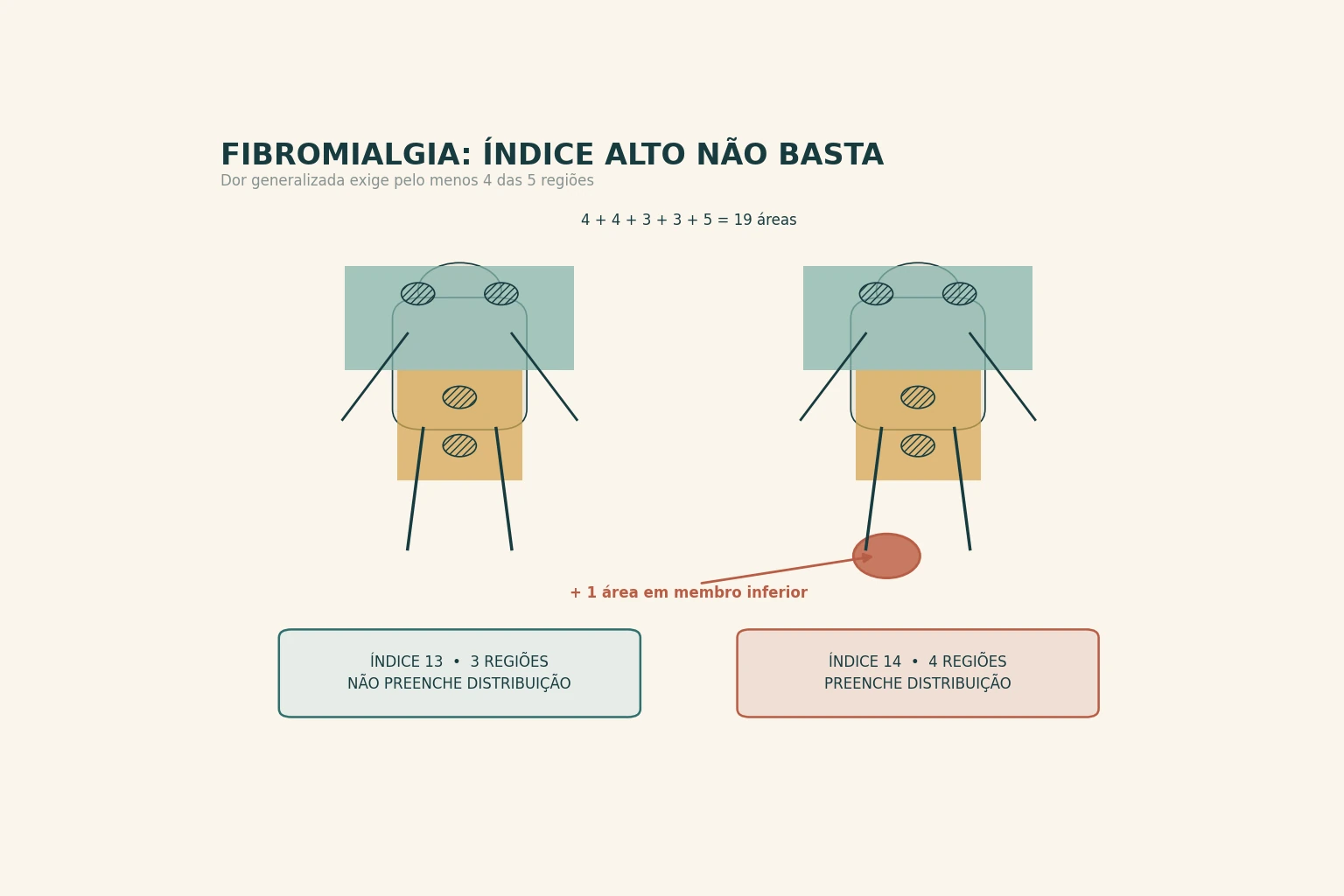 Dois mapas corporais esquemáticos divididos em cinco regiões, com 4, 4, 3, 3 e 5 áreas somando 19. No primeiro, índice de dor difusa 13, com as duas regiões superiores e a axial preenchidas: três regiões contam e o critério não é preenchido, mesmo somando escore de sintomas 12, que leva a 25 de um teto de 31. No segundo, uma área a mais em membro inferior leva o índice a 14 e acende a quarta região, preenchendo o critério de dor generalizada em pelo menos 4 das 5 regiões. Quatro áreas — mandíbula direita, mandíbula esquerda, tórax e abdome — aparecem hachuradas como áreas que contam para o índice sem fazer região valer.