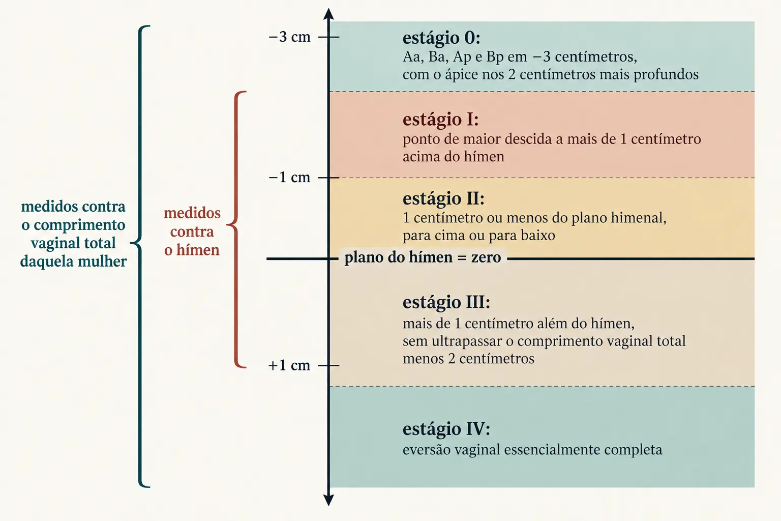 Escala vertical em centímetros com o plano do hímen marcado como zero, valores negativos acima e positivos abaixo. O estágio I fica acima de menos 1 centímetro; o estágio II ocupa a faixa estreita de menos 1 a mais 1; o estágio III fica abaixo de mais 1; e o estágio IV, na base, é a eversão completa. Uma faixa no alto, em menos 3 centímetros, marca o estágio 0. Chaves laterais indicam que I, II e III se medem contra o hímen e que 0 e IV se medem contra o comprimento vaginal total.