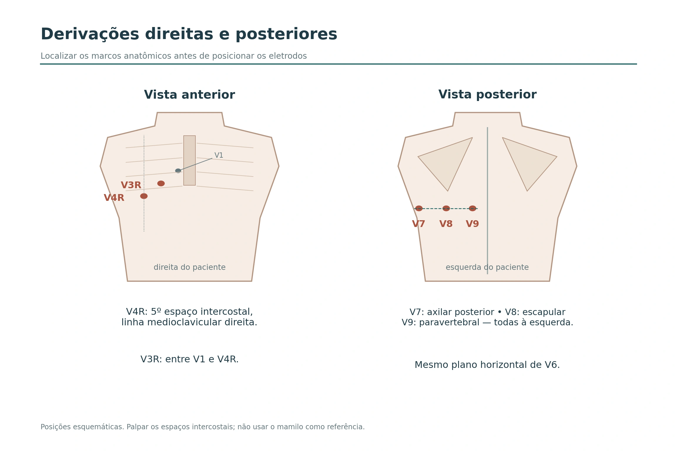Posições de V3R e V4R no hemitórax direito e de V7, V8 e V9 no hemitórax posterior esquerdo.