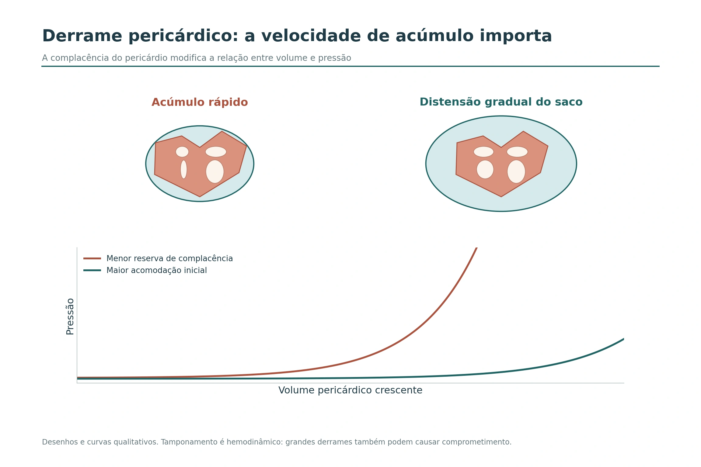 Pericárdio com menor reserva de distensão versus acomodação gradual, com curvas qualitativas de pressão e volume.