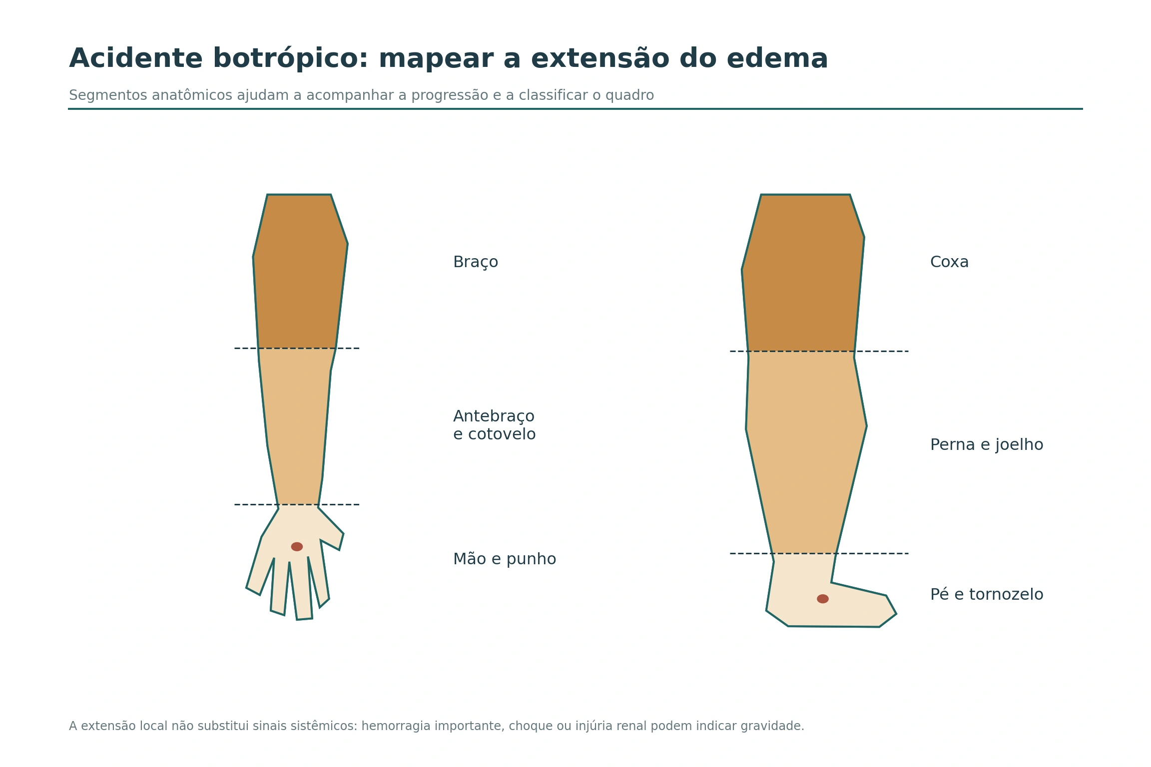 Braço e perna com três segmentos anatômicos destacados e ponto distal de inoculação.