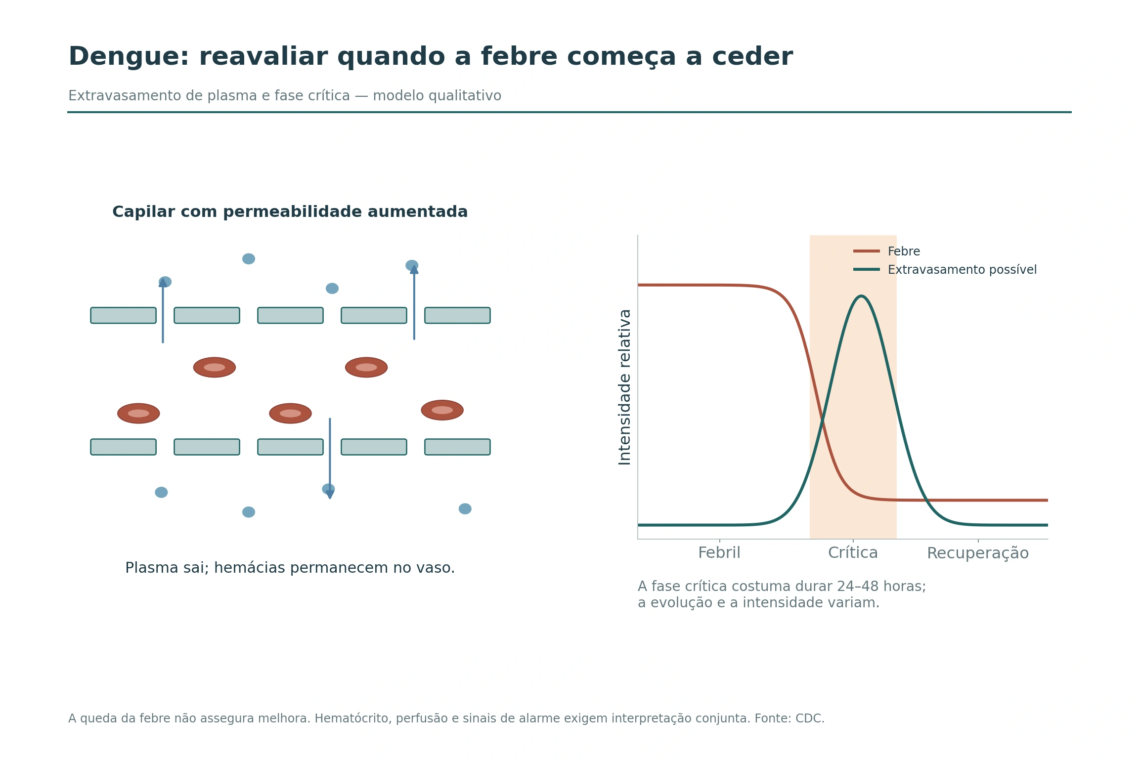 Saída de plasma através do endotélio capilar e curvas qualitativas de febre e extravasamento na dengue.