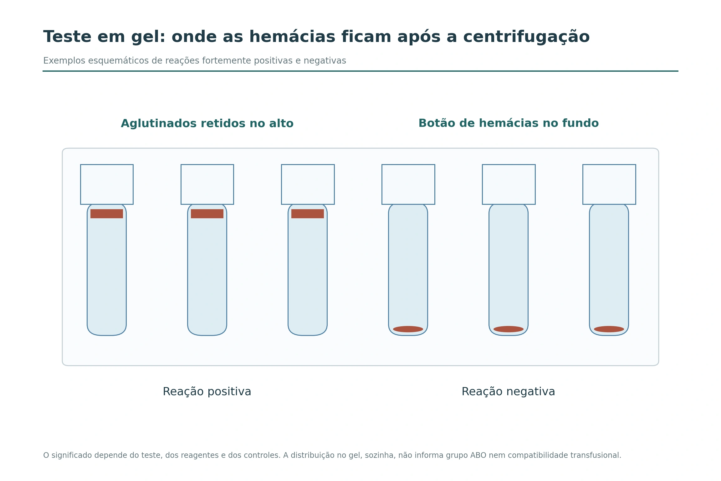 Seis microtubos de gel: três com hemácias retidas no alto e três com botão de hemácias no fundo.