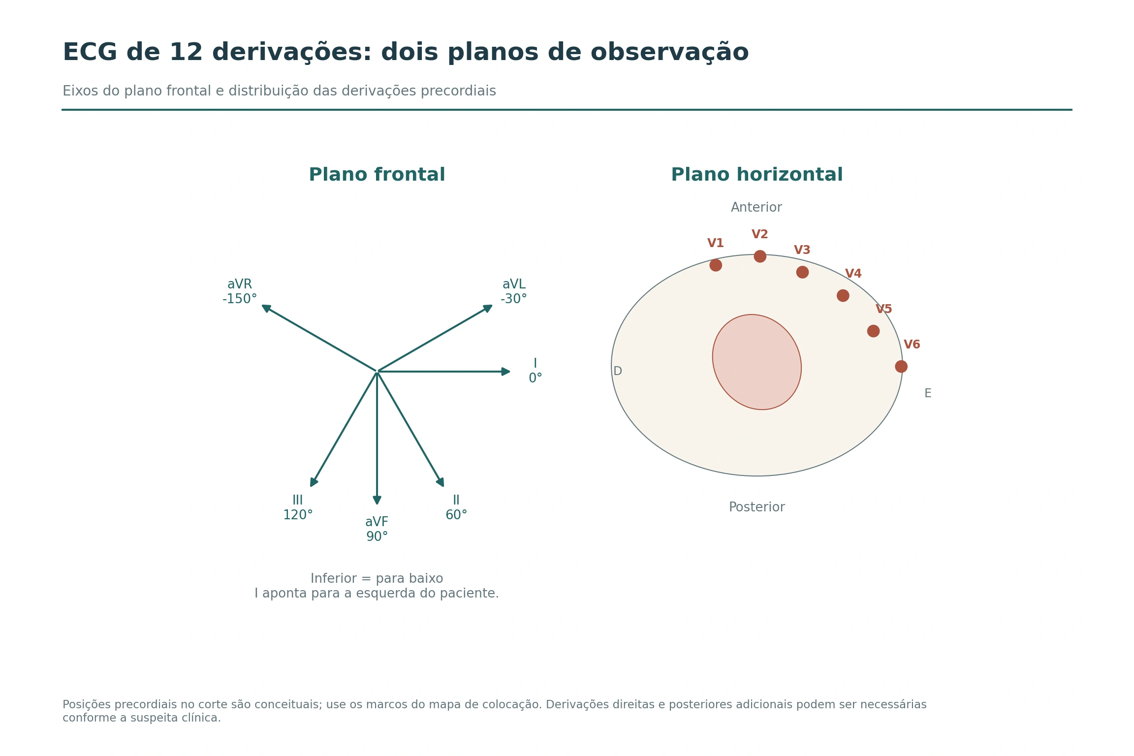 Diagrama hexaxial mostra I a zero grau, II a 60, III a 120, aVF a 90, aVL a menos 30 e aVR a menos 150; ao lado, corte transversal situa V1 a V6.