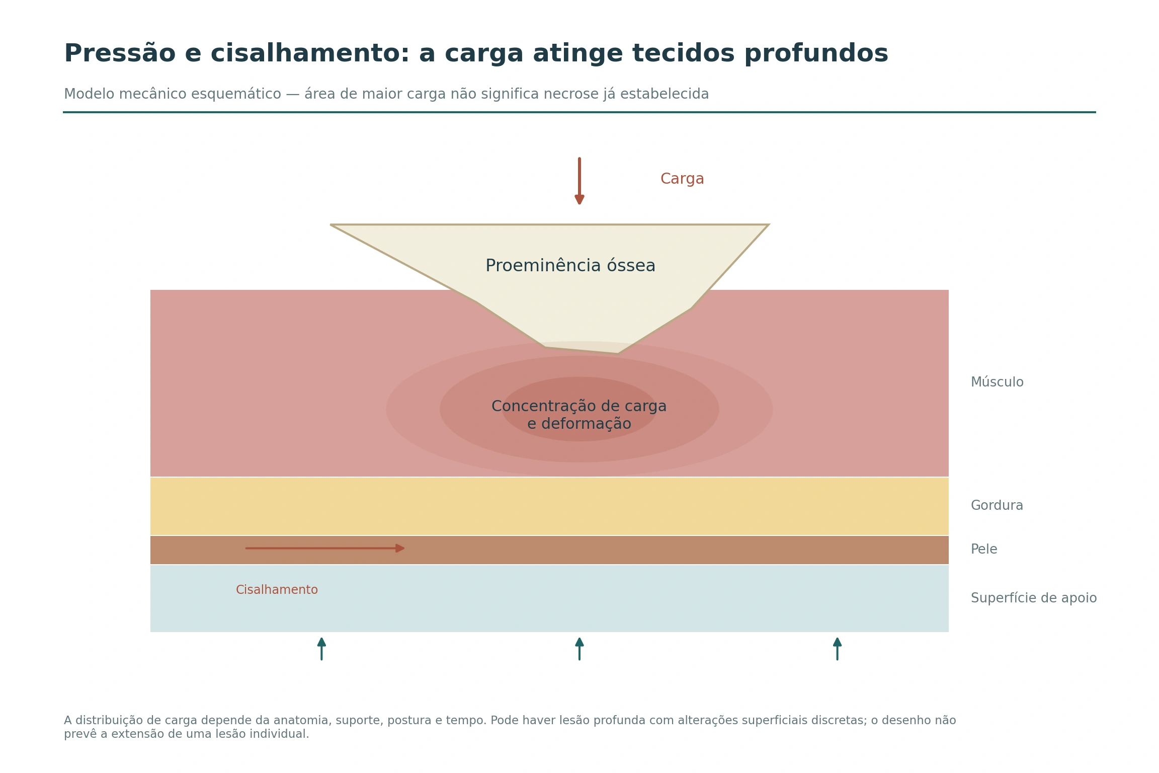 Proeminência óssea comprime camadas de músculo, gordura e pele contra a superfície de apoio; setas indicam carga, reação do apoio e componente de cisalhamento.