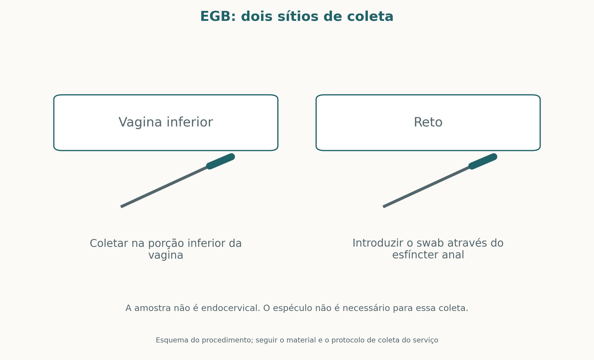 Dois sítios de coleta para cultura de estreptococo do grupo B: vagina inferior e reto, atravessando o esfíncter anal