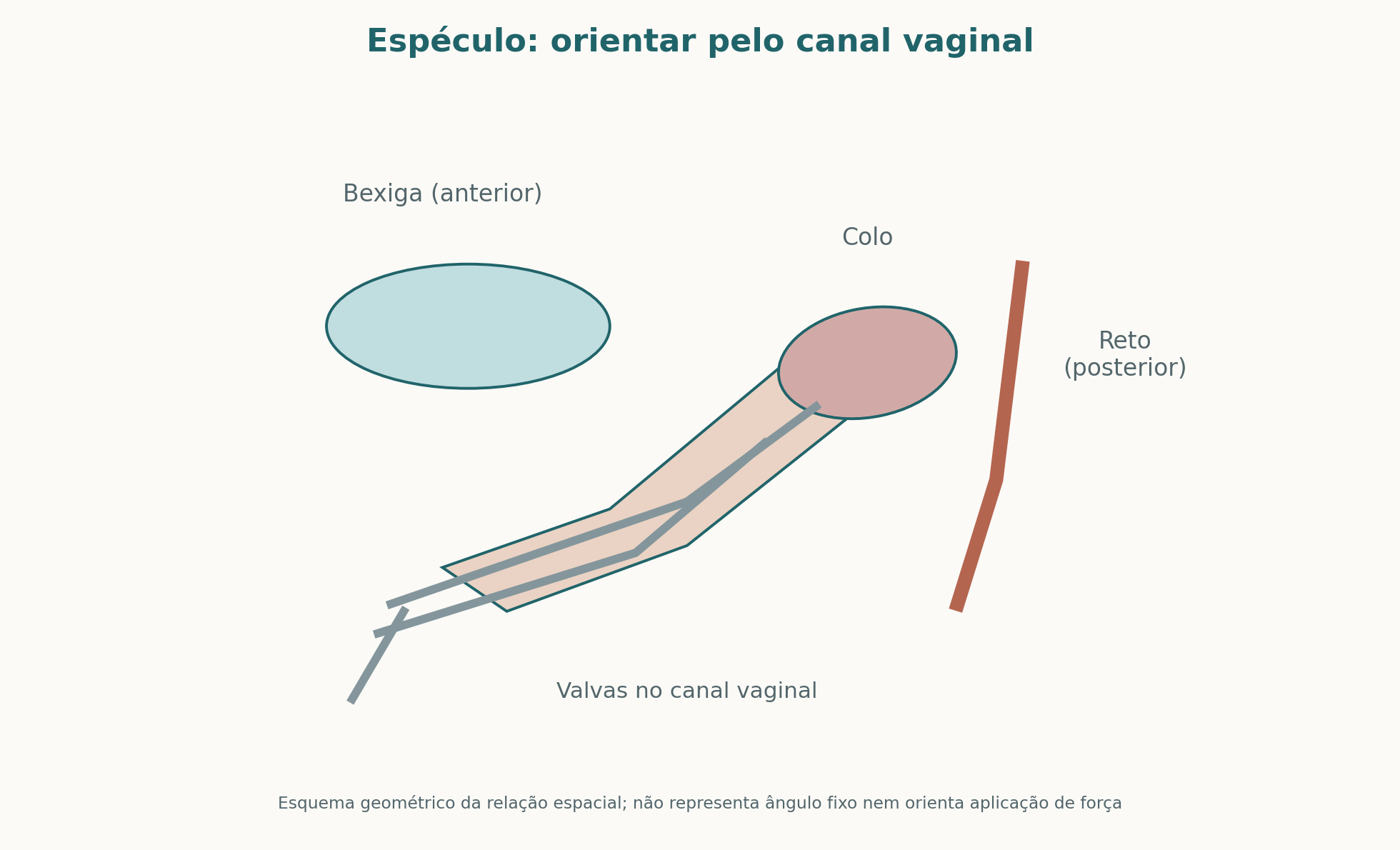 Diagrama geométrico da orientação do espéculo pelo canal vaginal até a visualização do colo