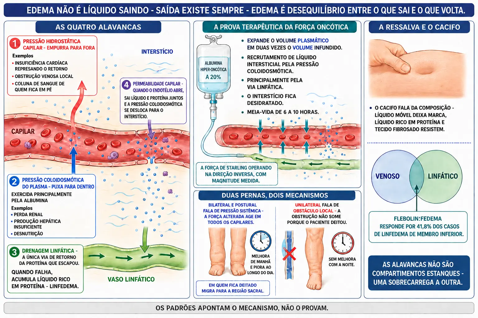 Capilar com as quatro alavancas do edema e o linfático, bolsa de albumina a 20% recrutando líquido do interstício, comparação entre edema bilateral postural e unilateral obstrutivo com relógios, e cacifo com diagrama de sobreposição venosa-linfática.
