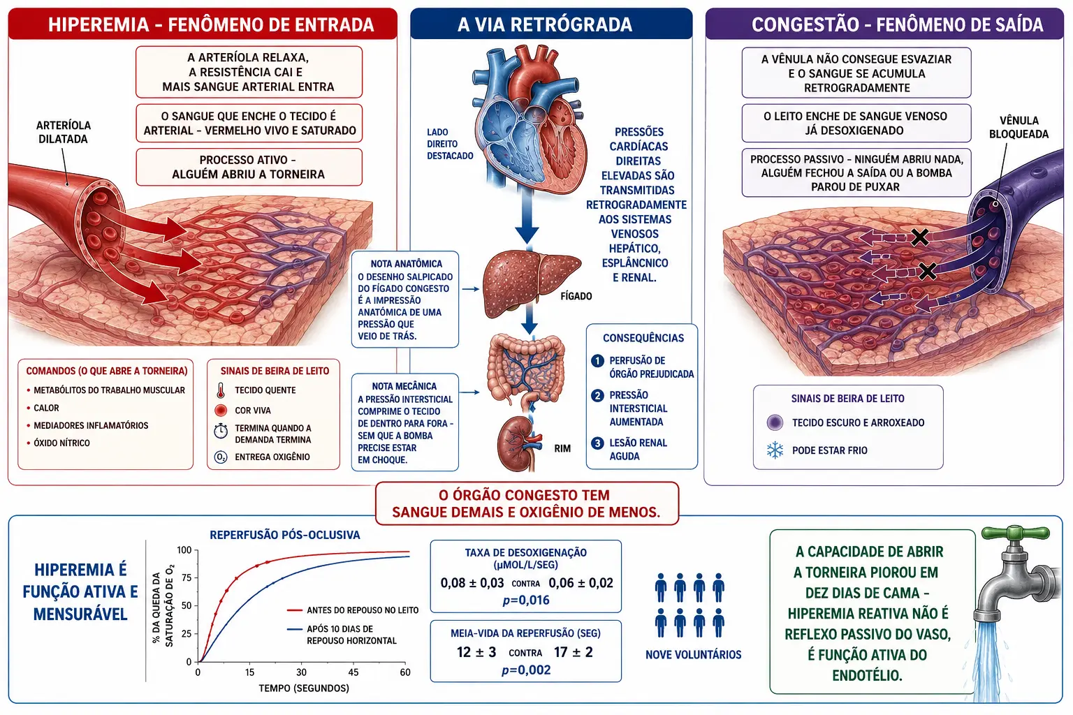 Comparação entre arteríola dilatada com sangue vermelho vivo entrando e vênula bloqueada com sangue escuro represado, coração direito transmitindo pressão retrógrada a fígado, leito esplâncnico e rim, e gráfico de reperfusão mais lenta após repouso no leito.
