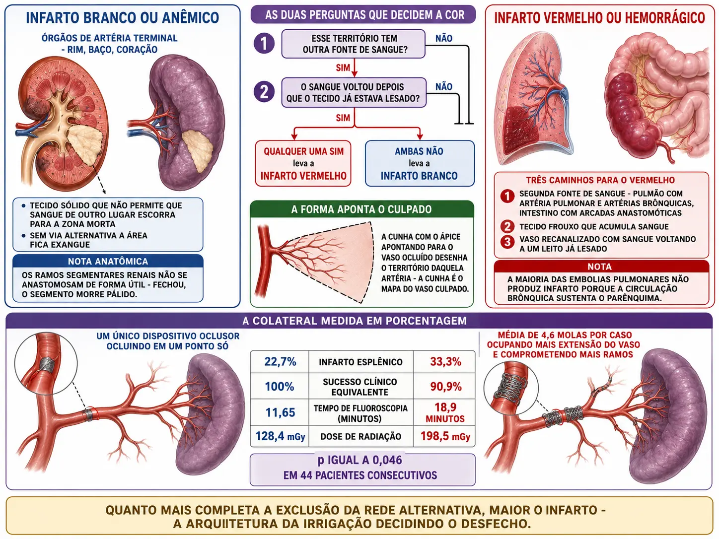 Rim e baço com cunhas pálidas de ápice hilar ao lado de pulmão e intestino com cunhas vermelho-escuras, fluxo com as duas perguntas que decidem a cor, esquema da cunha como mapa do vaso, e comparação de embolização com dispositivo único contra múltiplas molas.