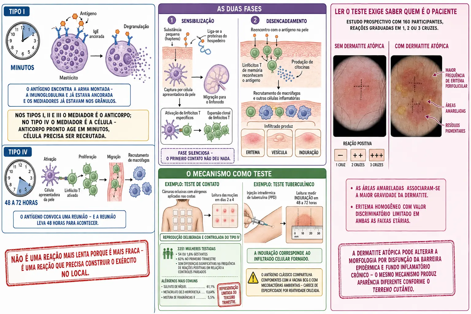 Quadros comparando mastócito armado do tipo I com linfócito T que precisa ser recrutado no tipo IV, sequência de sensibilização e desencadeamento, teste de contato e teste tuberculínico como reprodução do mecanismo, e campos dermatoscópicos com e sem dermatite atópica.