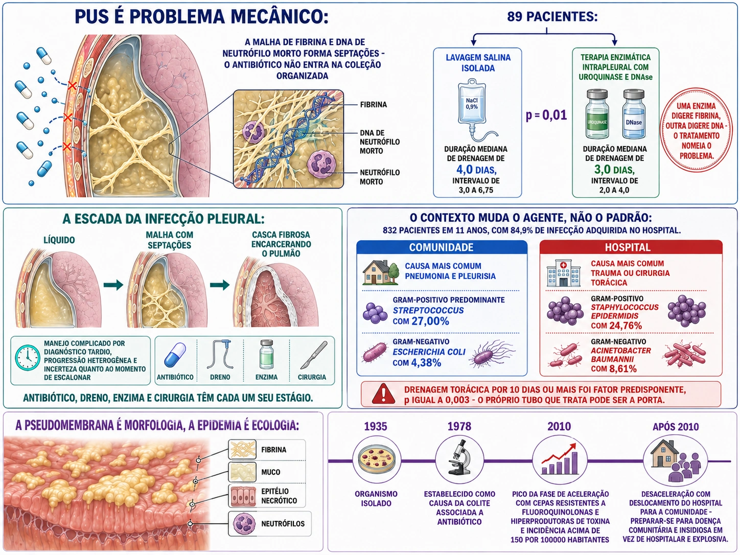 Cavidade pleural com coleção septada impermeável ao antibiótico e o ensaio comparando lavagem salina com terapia enzimática, escada de estágios da infecção pleural, cartões comparando infecção comunitária e hospitalar, e mucosa com pseudomembranas ao lado da linha do tempo epidemiológica.