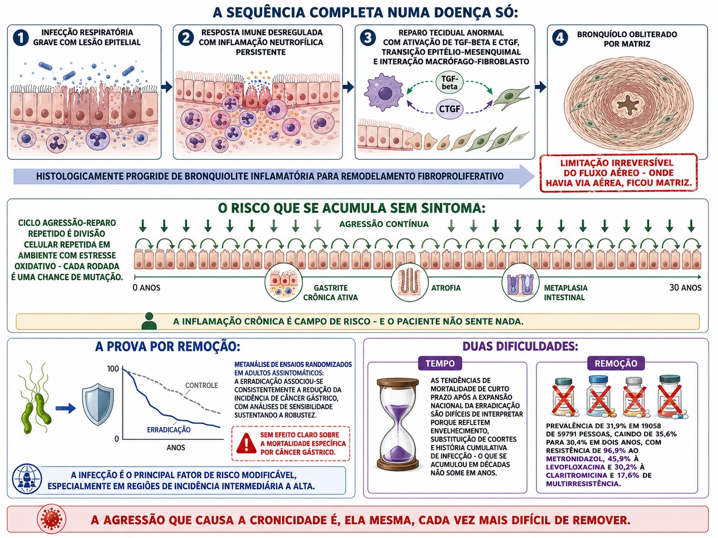 Quatro quadros da progressão da bronquiolite até obliteração por matriz, linha do tempo de trinta anos com epitélio em divisão repetida e marcos de gastrite, atrofia e metaplasia, curva de incidência caindo com a erradicação e sua fronteira, e cartões de tempo e resistência antimicrobiana.
