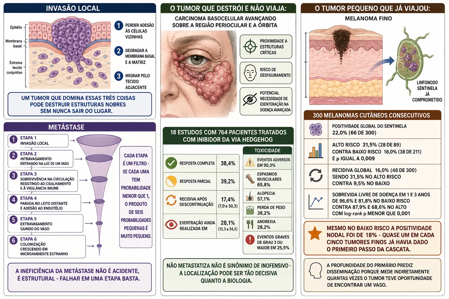 Quadros separando invasão local de cascata metastática com funil de seis filtros, face com carcinoma basocelular periocular e dados de exenteração e toxicidade, e melanoma fino com seta para linfonodo positivo e estatísticas da coorte.