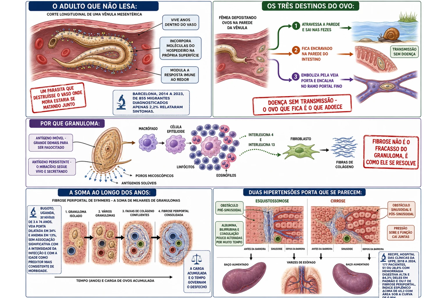 Casal adulto de Schistosoma mansoni camuflado dentro da vênula mesentérica, os três destinos possíveis do ovo, ampliação do granuloma montado em torno do ovo retido com fibroblasto depositando colágeno, linha do tempo da fibrose periportal e comparação entre obstáculo pré-sinusoidal da esquistossomose e obstáculo sinusoidal da cirrose.