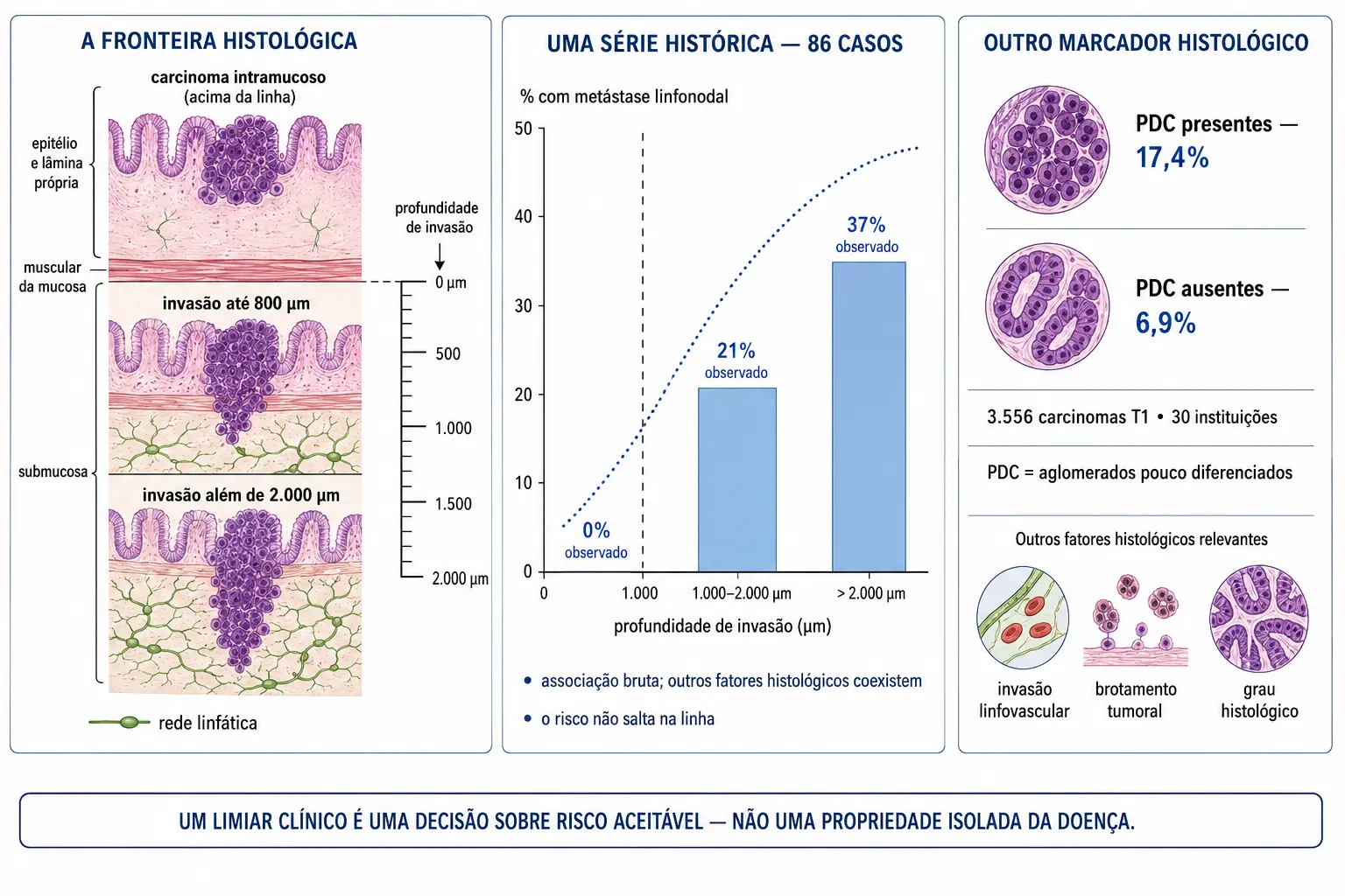 Corte da parede do cólon com régua em micrômetros a partir da muscular da mucosa e três tumores em profundidades diferentes, gráfico com 0%, 21% e 37% de metástase por faixa de profundidade com a linha do limiar sobre uma curva contínua, e comparação com o critério dos aglomerados pouco diferenciados.