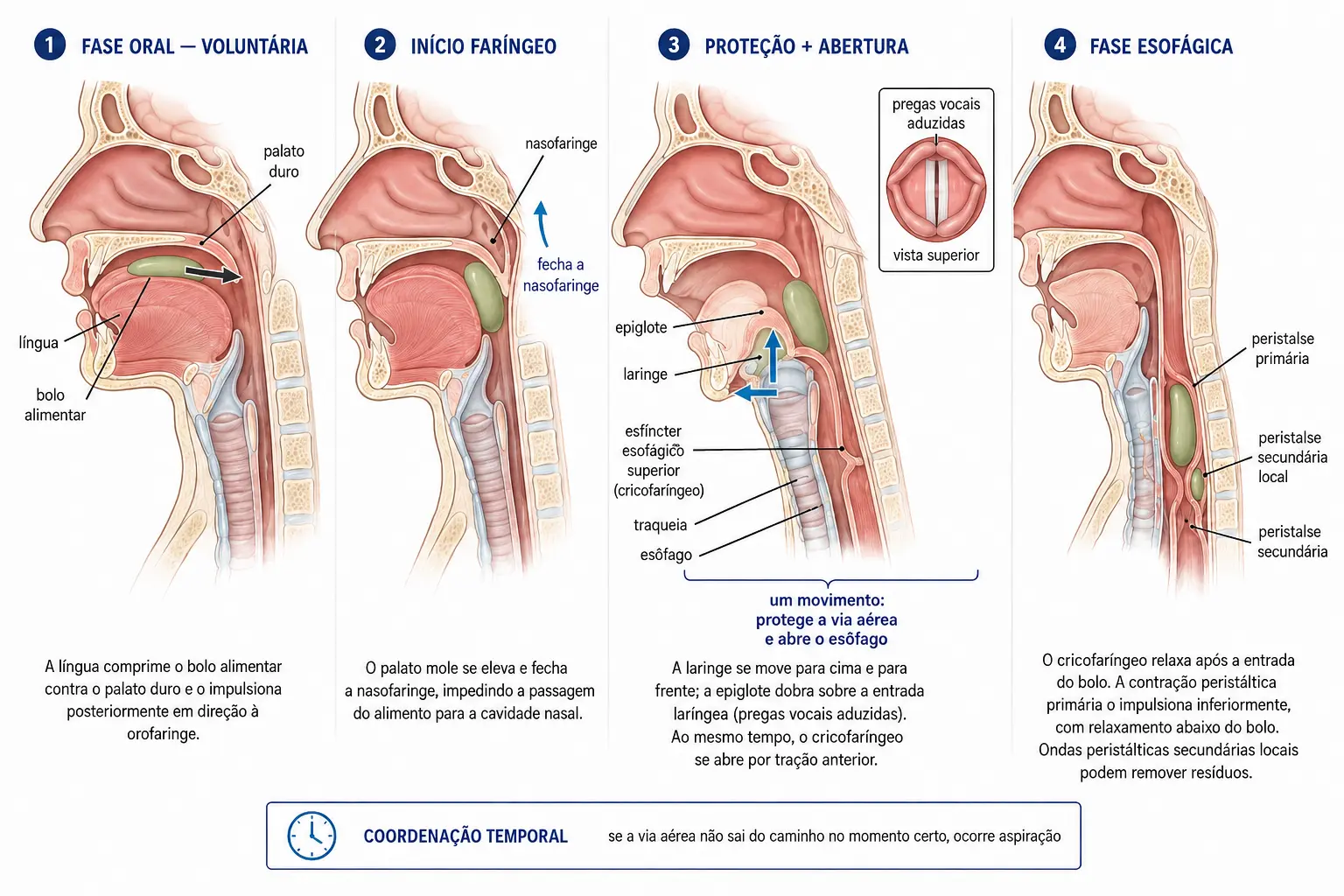 Quatro cortes sagitais sequenciais da deglutição mostrando a fase oral voluntária, a elevação do palato mole, a elevação e anteriorização da laringe com rebatimento da epiglote e abertura do esfíncter superior, e a peristalse esofágica.