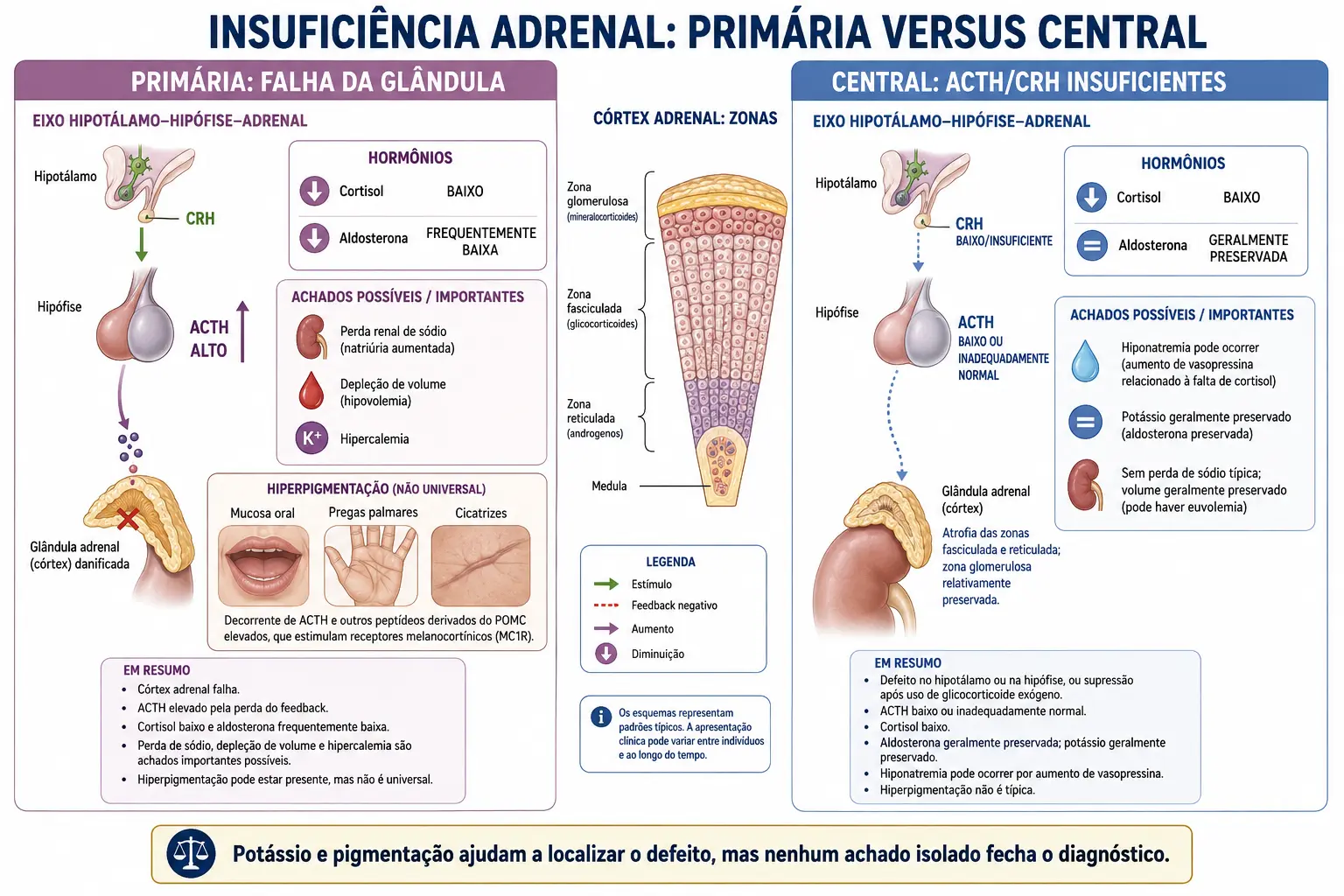 Duas colunas comparando insuficiência suprarrenal primária, com todas as zonas falhando, ACTH alto e hiperpigmentação, e secundária, com glomerulosa preservada, ACTH baixo e ausência de pigmentação.