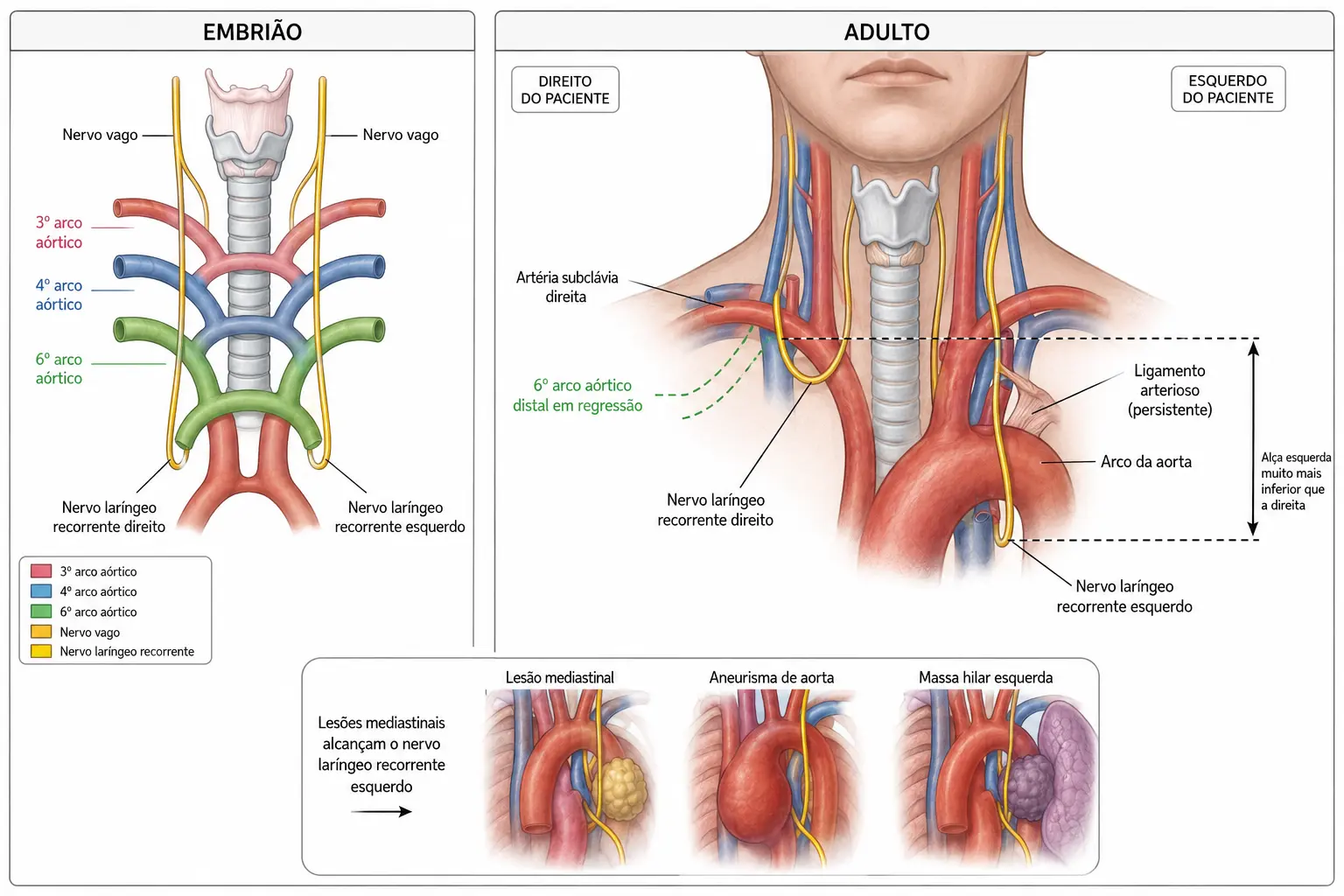 Painel duplo mostrando os arcos aórticos com os nervos recorrentes simétricos no embrião e, no adulto, o direito em alça na subclávia no pescoço e o esquerdo em alça no arco da aorta no tórax.