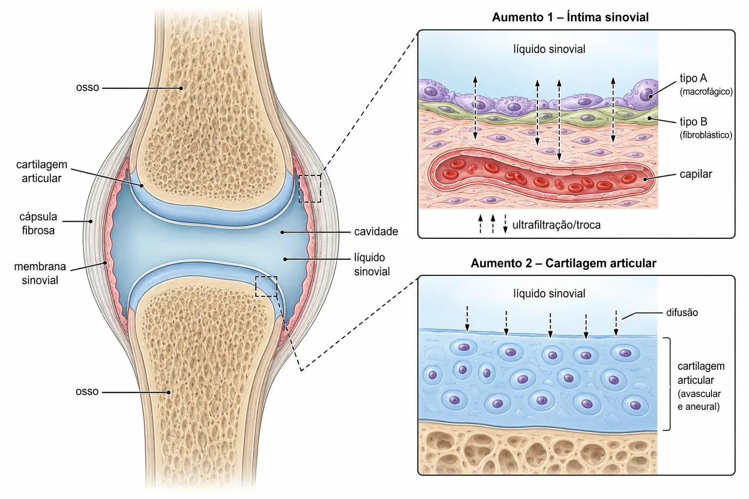 Corte de articulação sinovial mostrando cartilagem articular avascular, cápsula fibrosa, membrana sinovial vascularizada sem membrana basal e cavidade com líquido sinovial.
