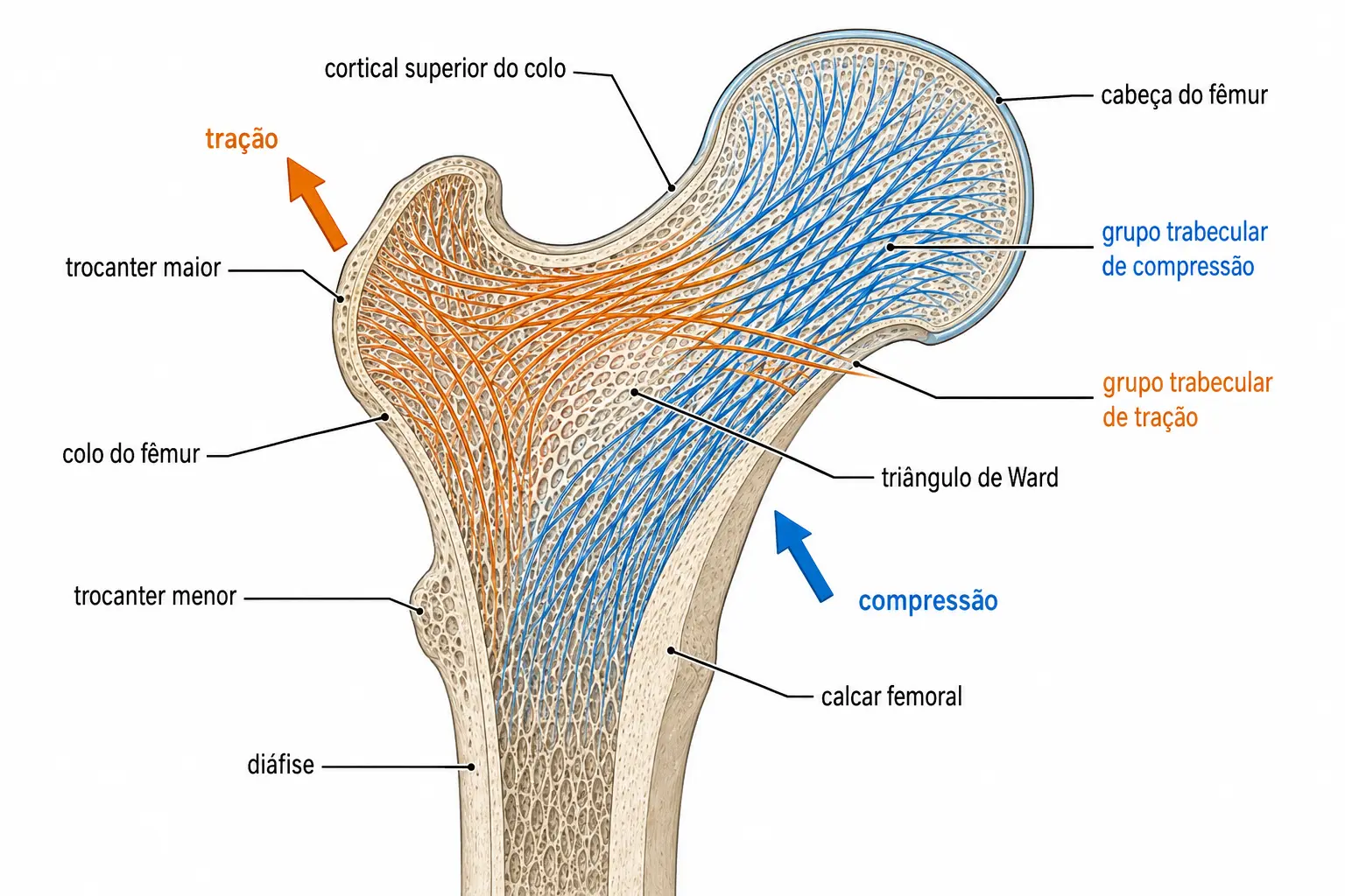 Corte frontal do fêmur proximal com dois sistemas de trabéculas cruzadas, um de compressão saindo do calcar e outro de tração saindo do trocanter maior, e o triângulo de Ward com trabéculas escassas entre eles.