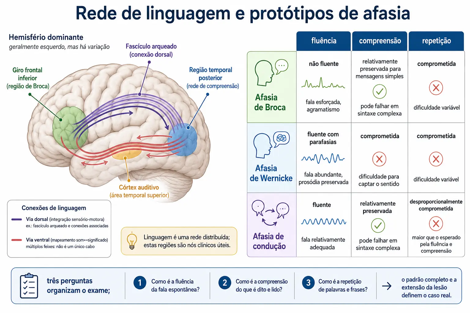 Hemisfério dominante com as áreas de Broca e Wernicke e o fascículo arqueado que as liga, e tabela visual cruzando fluência, compreensão e repetição nos três quadros correspondentes.