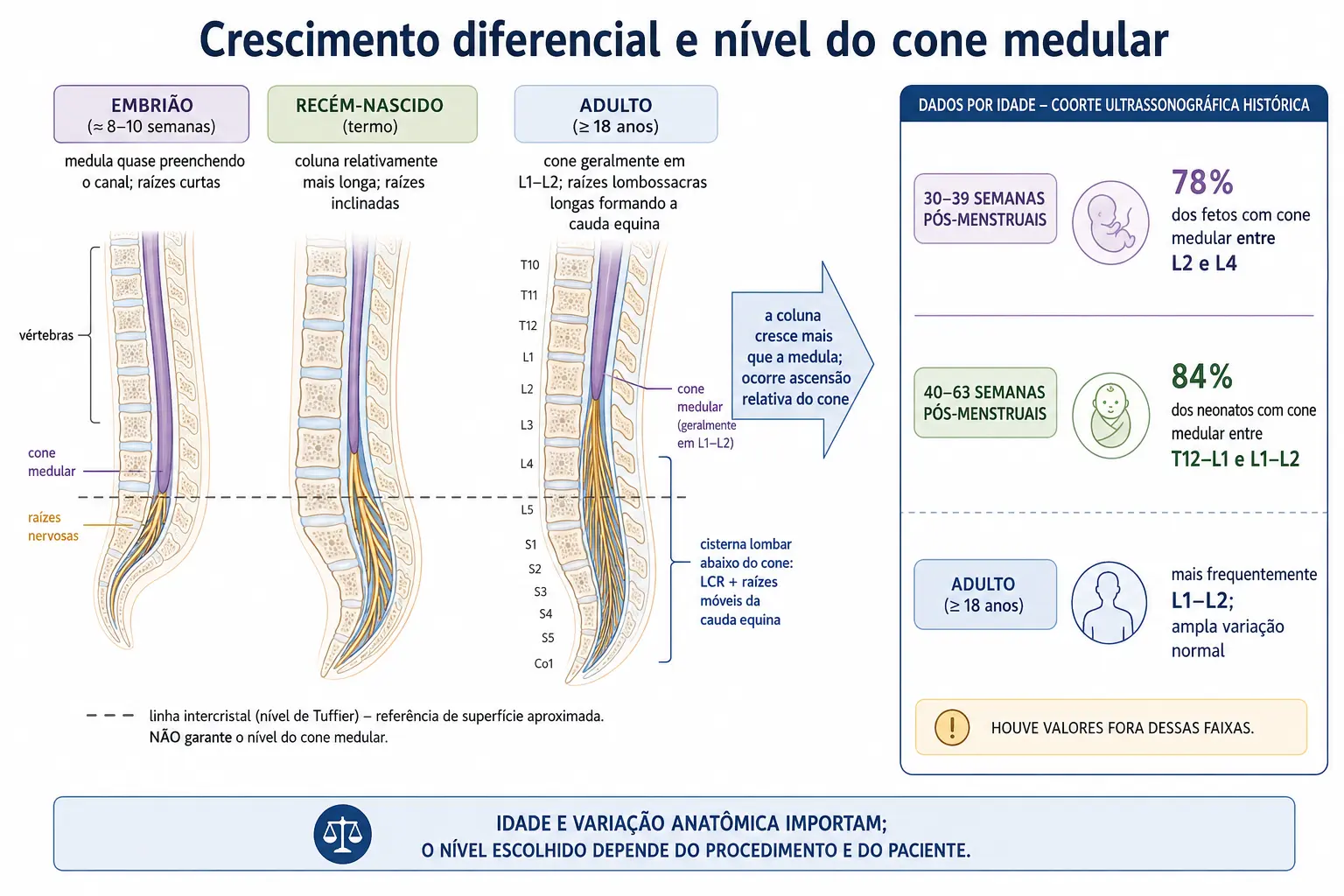 Comparação da coluna do embrião ao adulto com a medula ficando para trás, a cauda equina e os níveis do cone no adulto, no recém-nascido e no lactente.