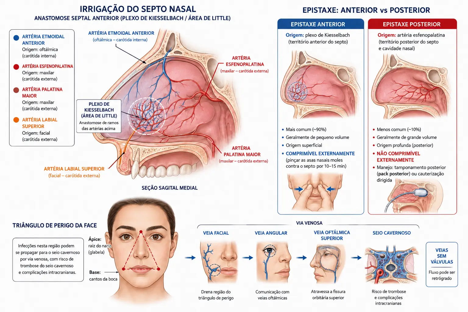 Septo nasal com as quatro artérias do plexo de Kiesselbach coloridas por território carotídeo, blocos comparando epistaxe anterior e posterior, e o triângulo de perigo da face com a via venosa até o seio cavernoso.