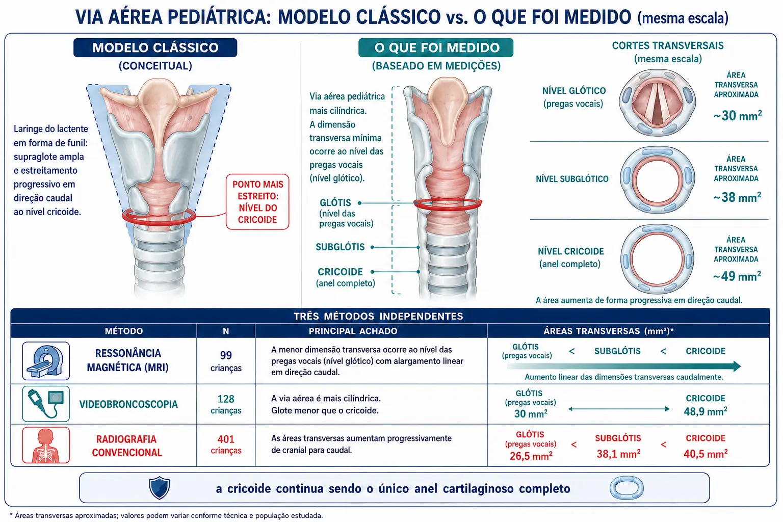 Painel duplo comparando a laringe pediátrica em forma de funil com estreito na cricoide, do modelo clássico, e as medidas mais cilíndricas e a menor dimensão glótica observadas nas amostras estudadas, acompanhado de uma tabela com os três métodos, amostras e resultados.