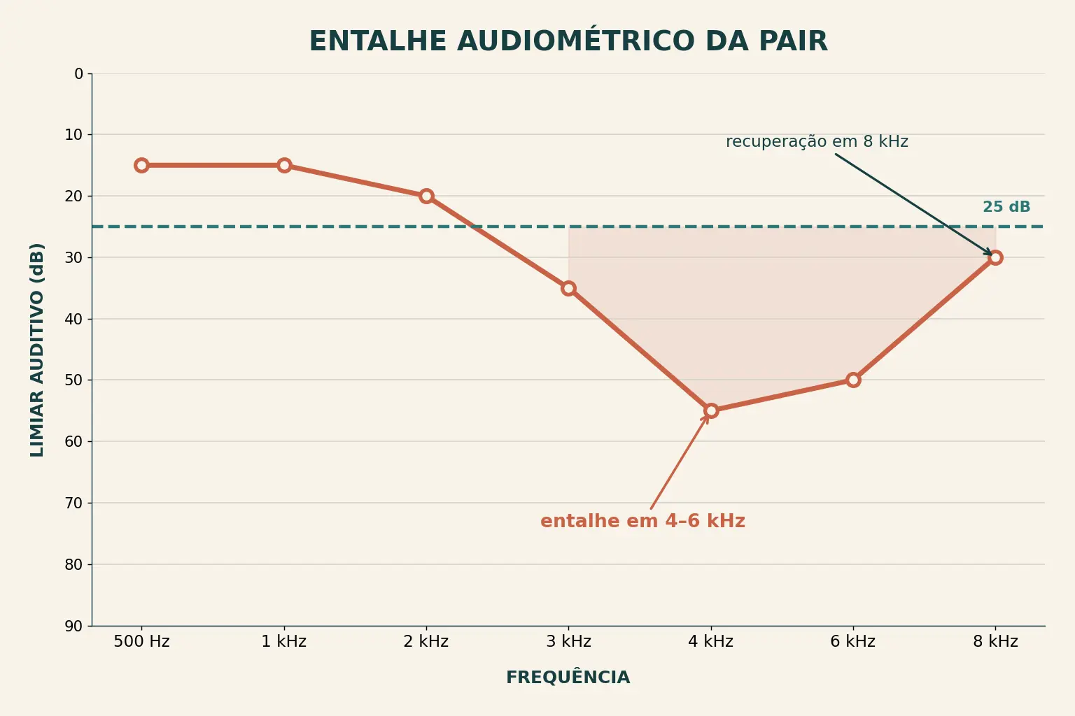 Audiograma com entalhe em 4 e 6 kHz e recuperação em 8 kHz, padrão da perda auditiva induzida por ruído.