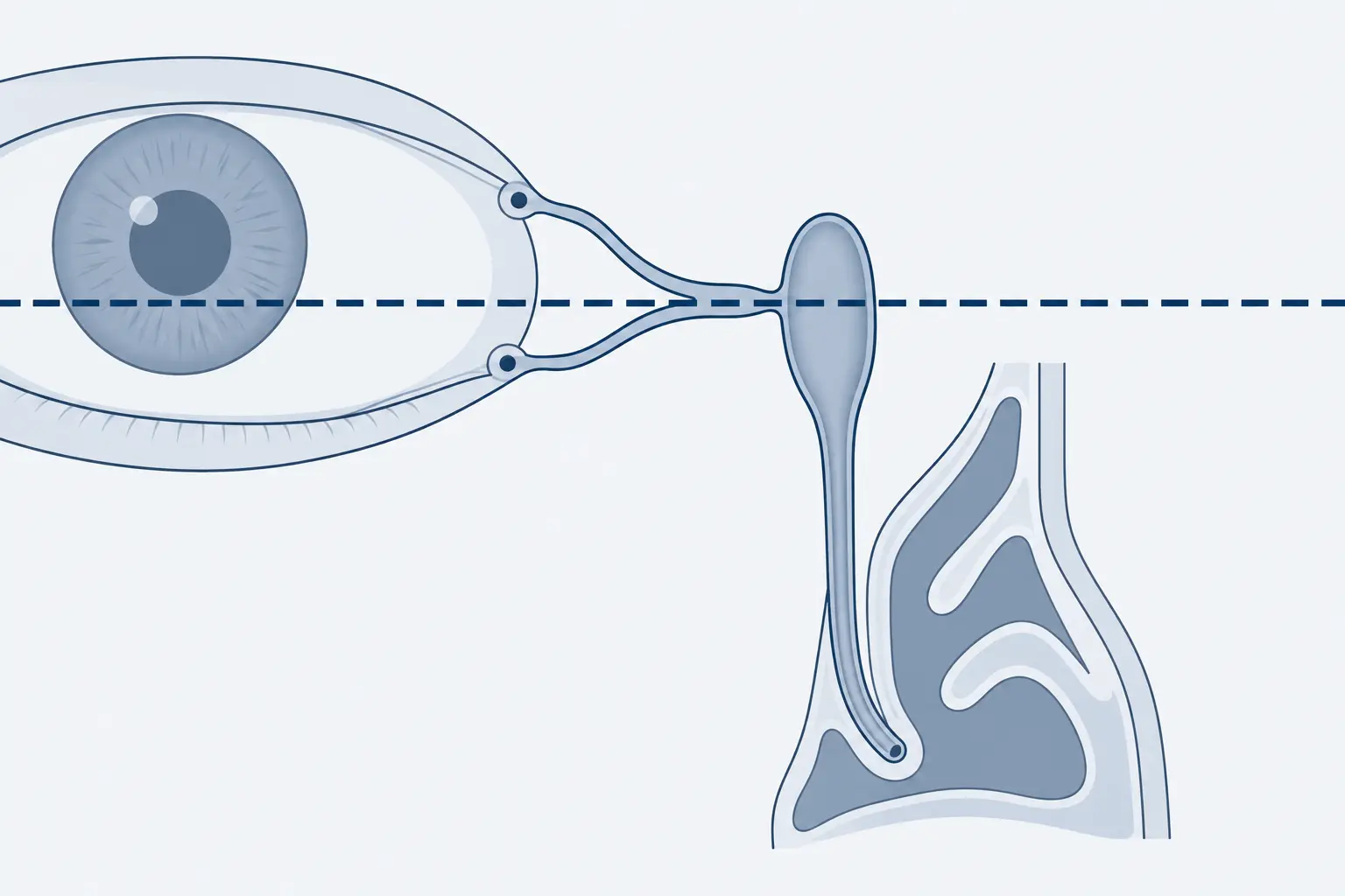 Esquema do canto medial mostrando os dois pontos lacrimais, os canalículos que convergem num canal único, o saco lacrimal e o ducto que desce até o nariz, com uma linha tracejada horizontal marcando o nível do tendão cantal medial.