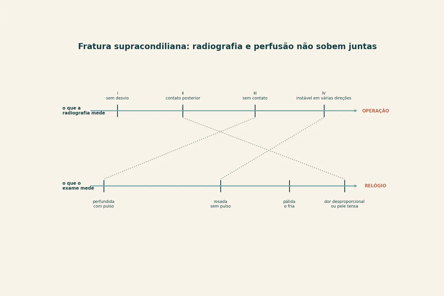 Duas réguas empilhadas, a de cima com os quatro tipos de Gartland terminando na palavra operação e a de baixo com os quatro estados de perfusão terminando na palavra relógio, ligadas por linhas pontilhadas que não se correspondem.