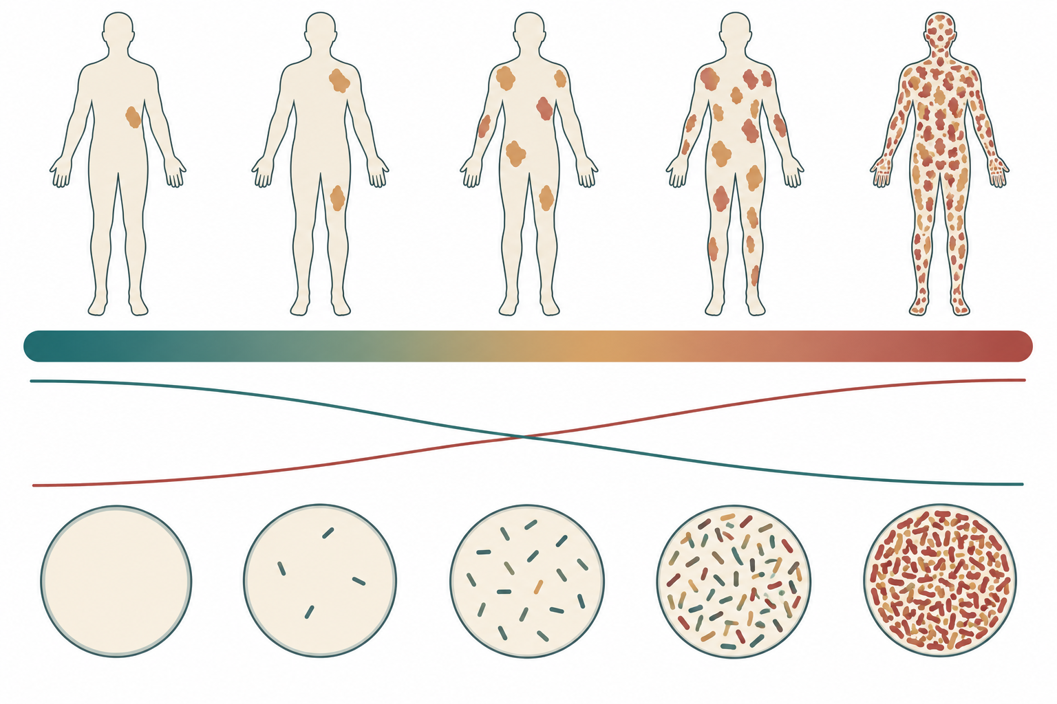 Faixa horizontal em gradiente com cinco silhuetas humanas acima, mostrando número crescente de manchas na pele da esquerda para a direita, e cinco círculos abaixo com quantidade crescente de bacilos. Duas curvas finas atravessam a faixa em sentidos opostos e se cruzam no meio.