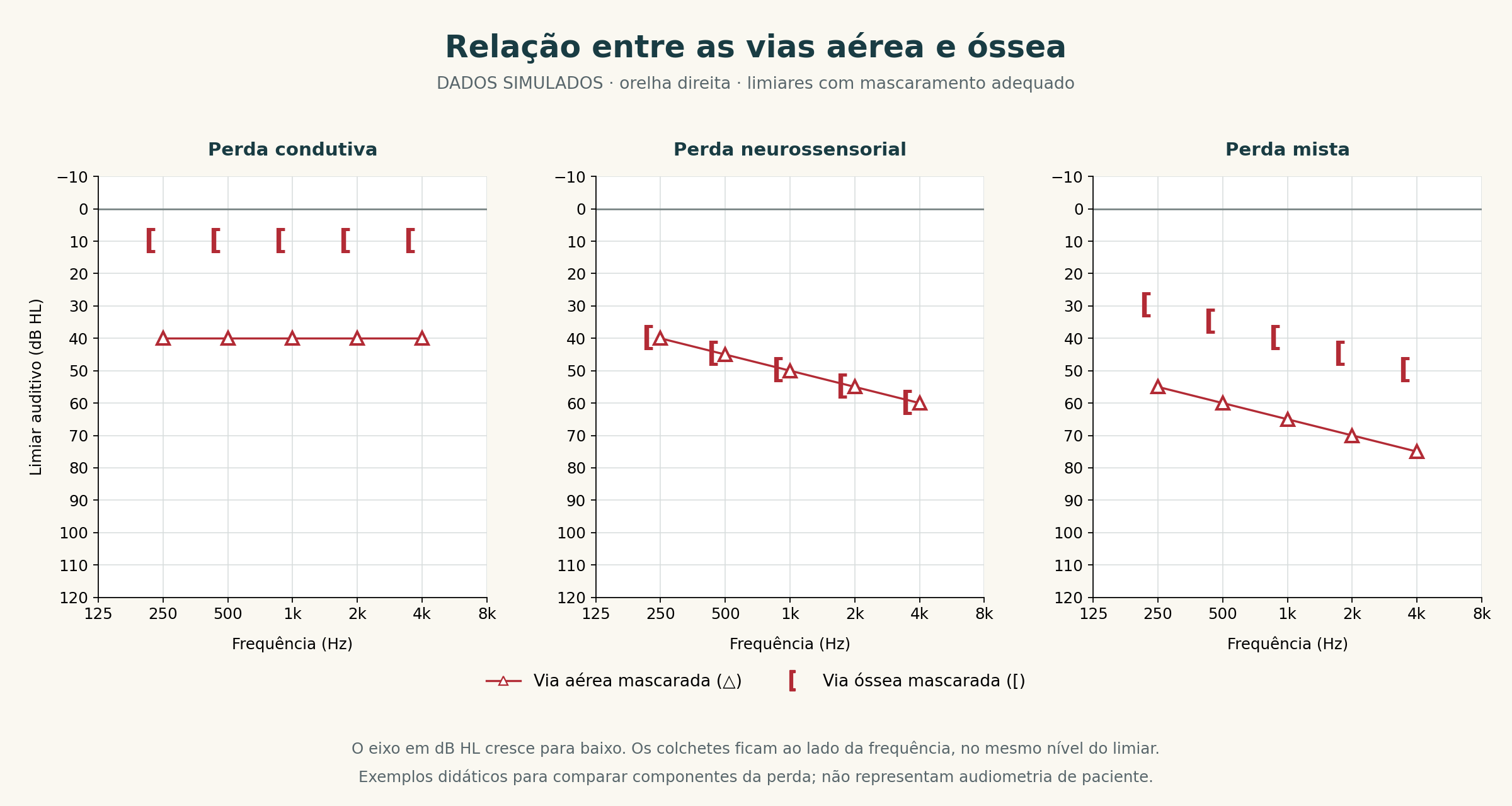 Três audiogramas simulados com padrões condutivo, neurossensorial e misto e símbolos de mascaramento.