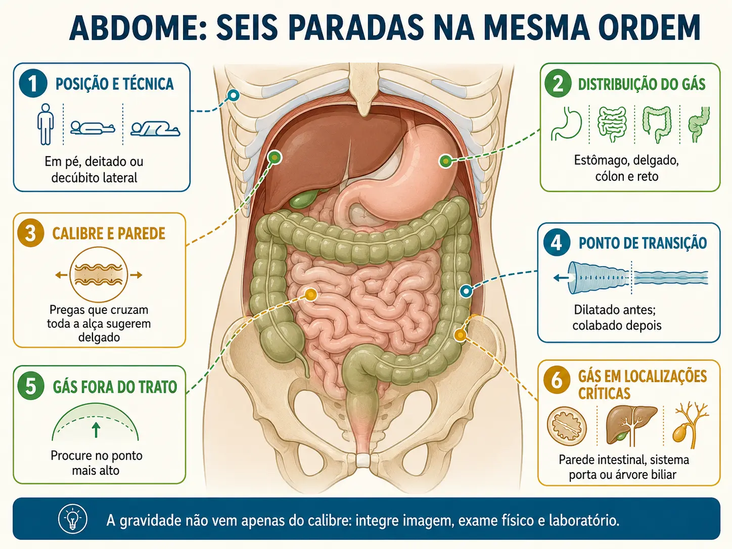Esquema de radiografia de abdome com seis marcadores numerados, da posição do paciente ao gás em parede, vasos e árvore biliar.