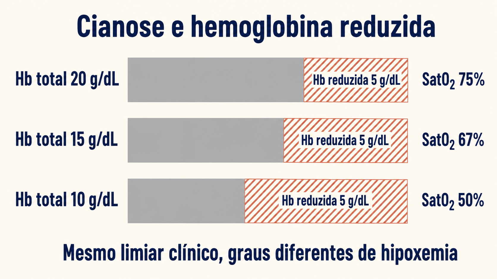 Três barras horizontais de comprimentos diferentes representando hemoglobina total de 20, 15 e 10 g/dL. Em todas, um segmento hachurado de mesmo tamanho marca 5 g/dL de hemoglobina reduzida, ocupando fração crescente da barra. Ao lado de cada uma, a saturação em que a cianose aparece: 75%, 67% e 50%.