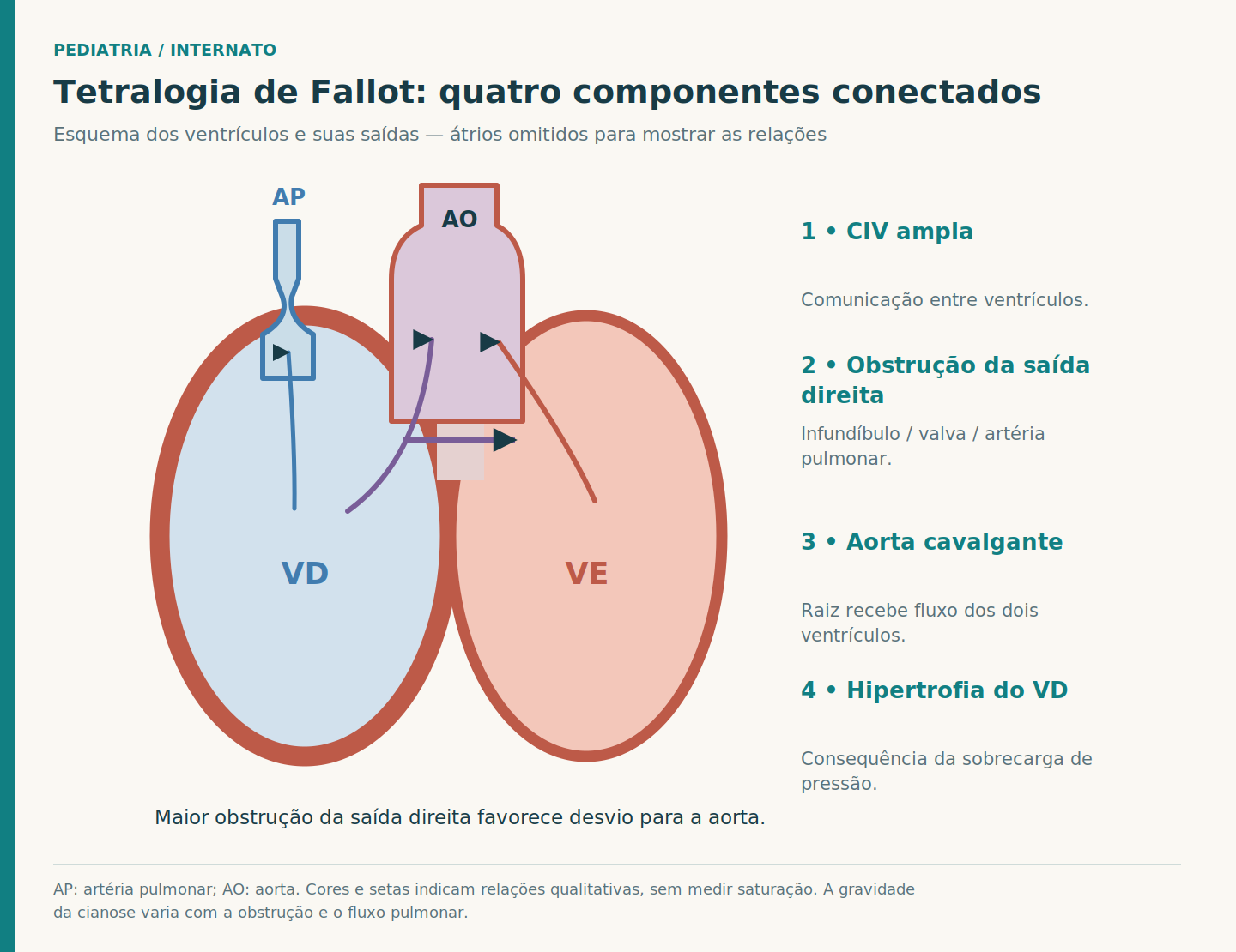 Esquema de dois ventrículos com CIV ampla, aorta sobre a comunicação, saída pulmonar estreita e parede do ventrículo direito espessada; setas qualitativas mostram fluxo para as saídas.