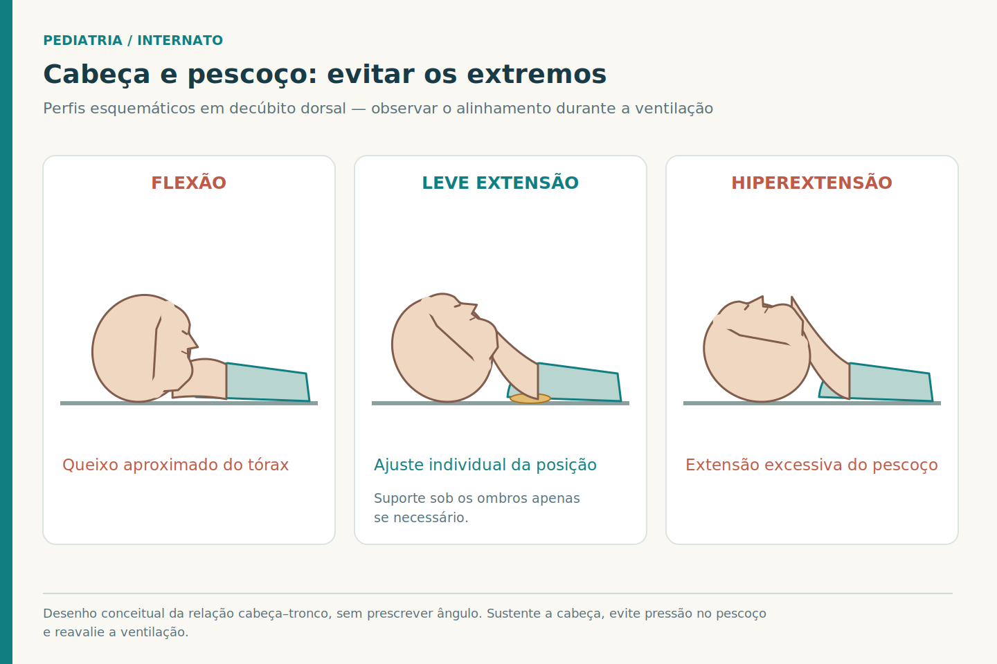 Três perfis geométricos de cabeça e tronco em decúbito dorsal, comparando flexão, leve extensão e hiperextensão; há suporte ilustrativo sob os ombros no painel central.