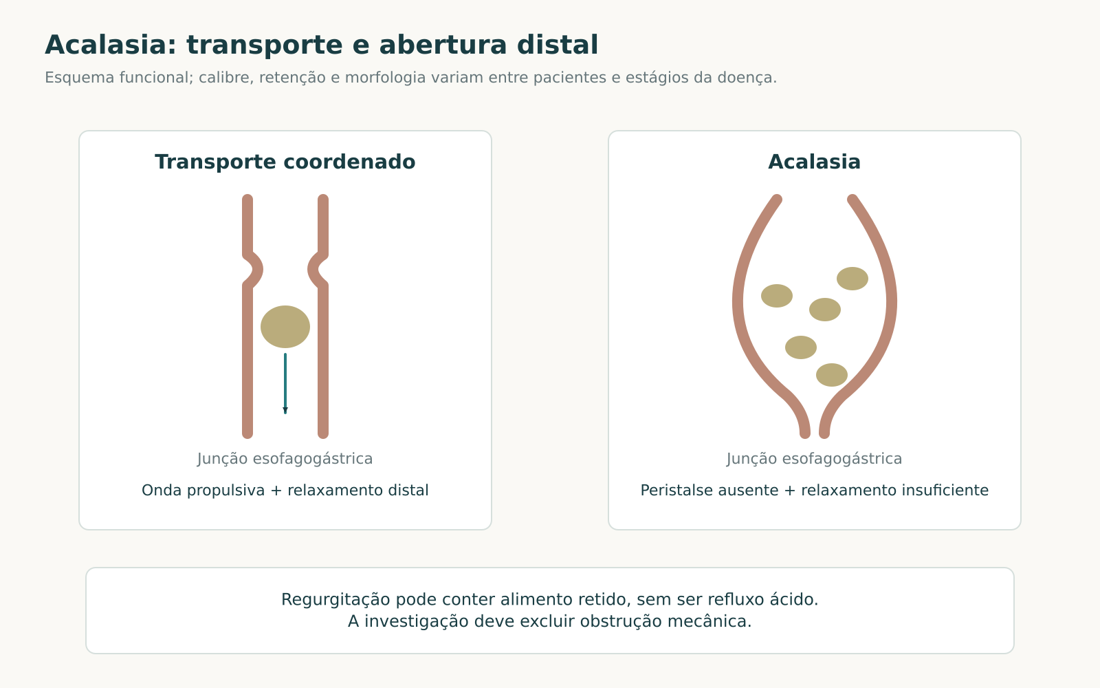 Comparação funcional entre esôfago com transporte coordenado e esôfago com retenção de conteúdo e abertura distal reduzida na acalasia.
