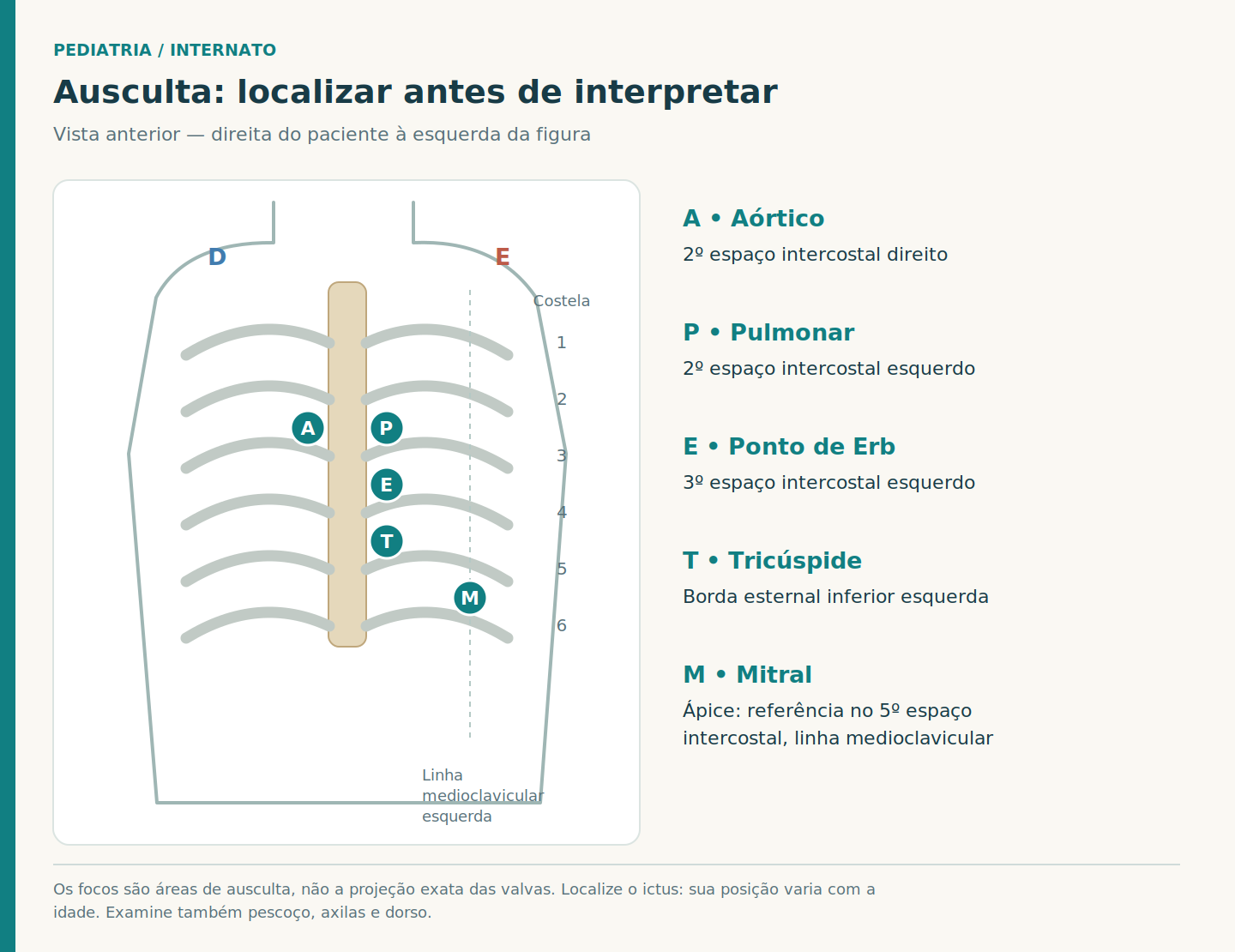 Parede torácica anterior esquemática com seis pares de costelas, esterno e cinco marcadores de ausculta: aórtico, pulmonar, Erb, tricúspide e mitral; direita e esquerda do paciente estão indicadas.