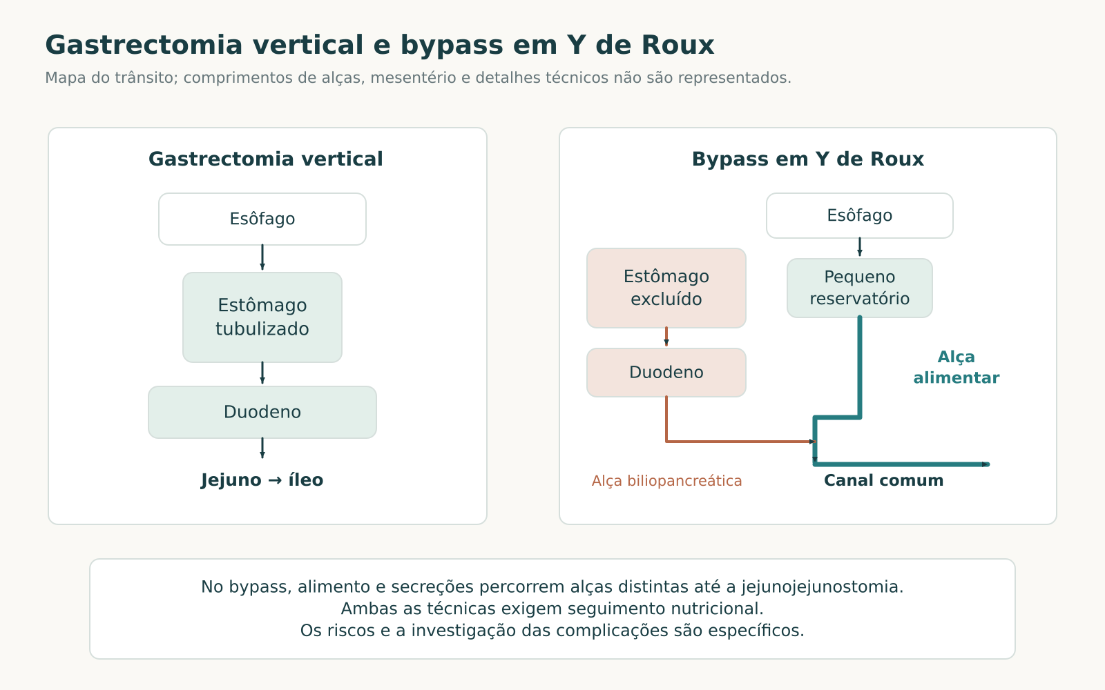 Mapas do trânsito após gastrectomia vertical e bypass em Y de Roux, com alças alimentar e biliopancreática unindo-se antes do canal comum.