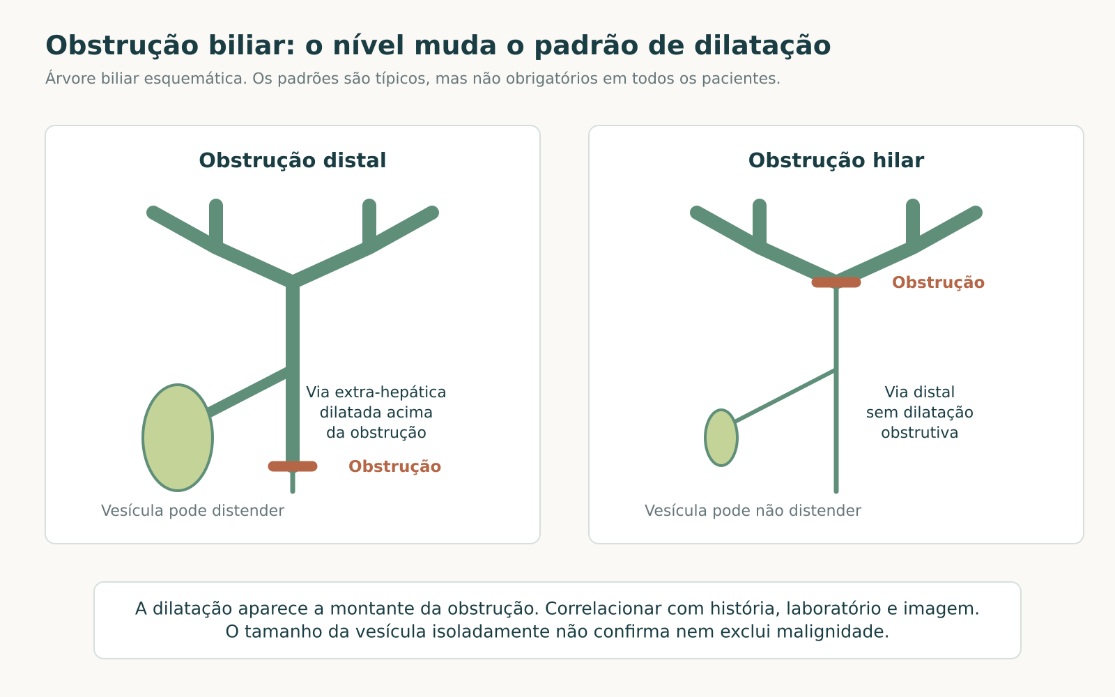 Duas árvores biliares esquemáticas comparam obstrução distal, dilatação a montante e possível distensão vesicular com obstrução hilar e via distal sem dilatação obstrutiva.