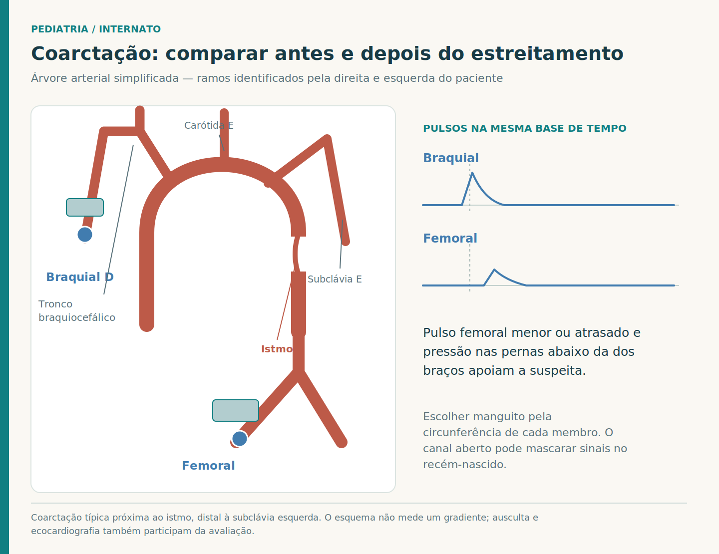 Árvore arterial com os três ramos do arco aórtico, estreitamento após a subclávia esquerda, marcadores braquial e femoral, manguitos e ondas de pulso alinhadas para comparação.