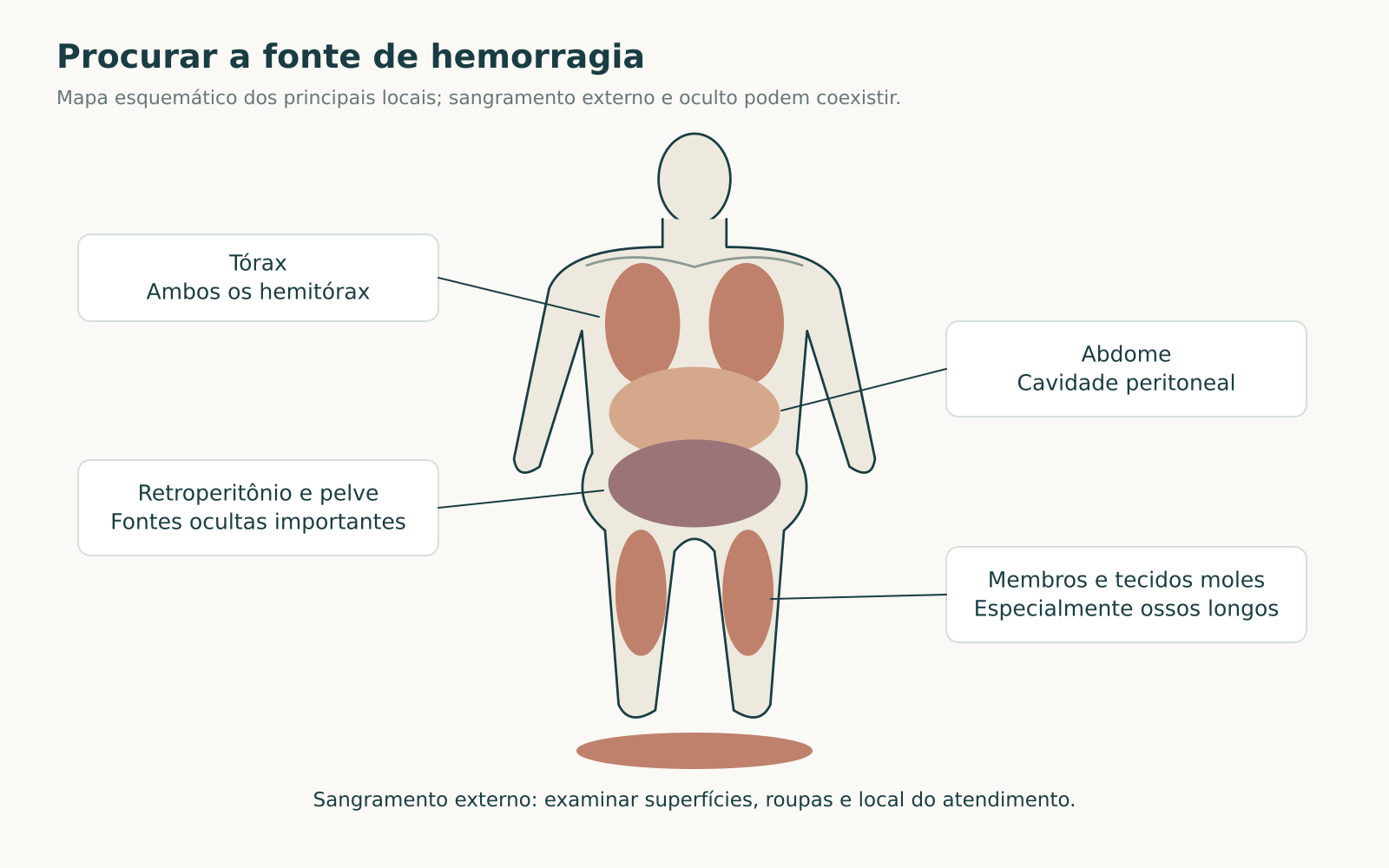 Mapa frontal esquemático com tórax, abdome, retroperitônio e pelve, membros e sangramento externo destacados como fontes de hemorragia.