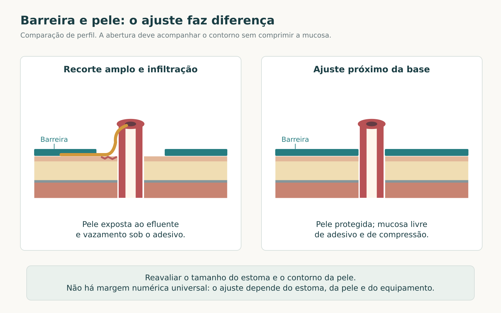 Cortes de perfil com abertura ampla da barreira e efluente sobre a pele e sob o adesivo, comparados a ajuste próximo da base.