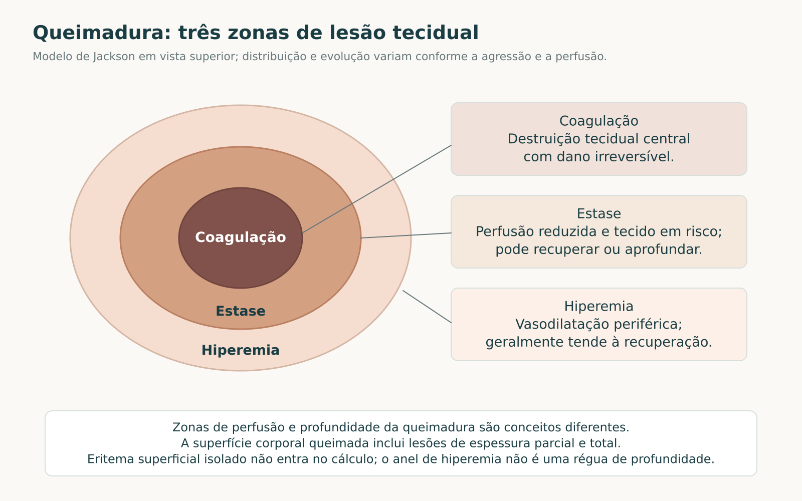 Esquema em vista superior de três zonas concêntricas de queimadura: coagulação central, estase intermediária e hiperemia periférica.