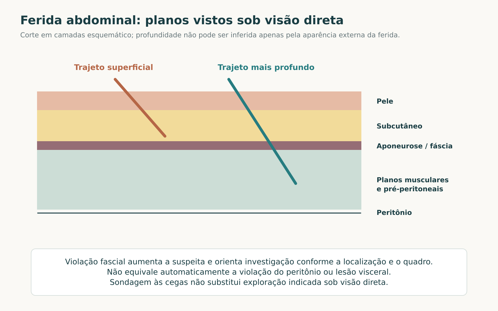 Corte esquemático da parede abdominal com trajeto superficial e trajeto que ultrapassa a fáscia, mantendo o peritônio representado abaixo.