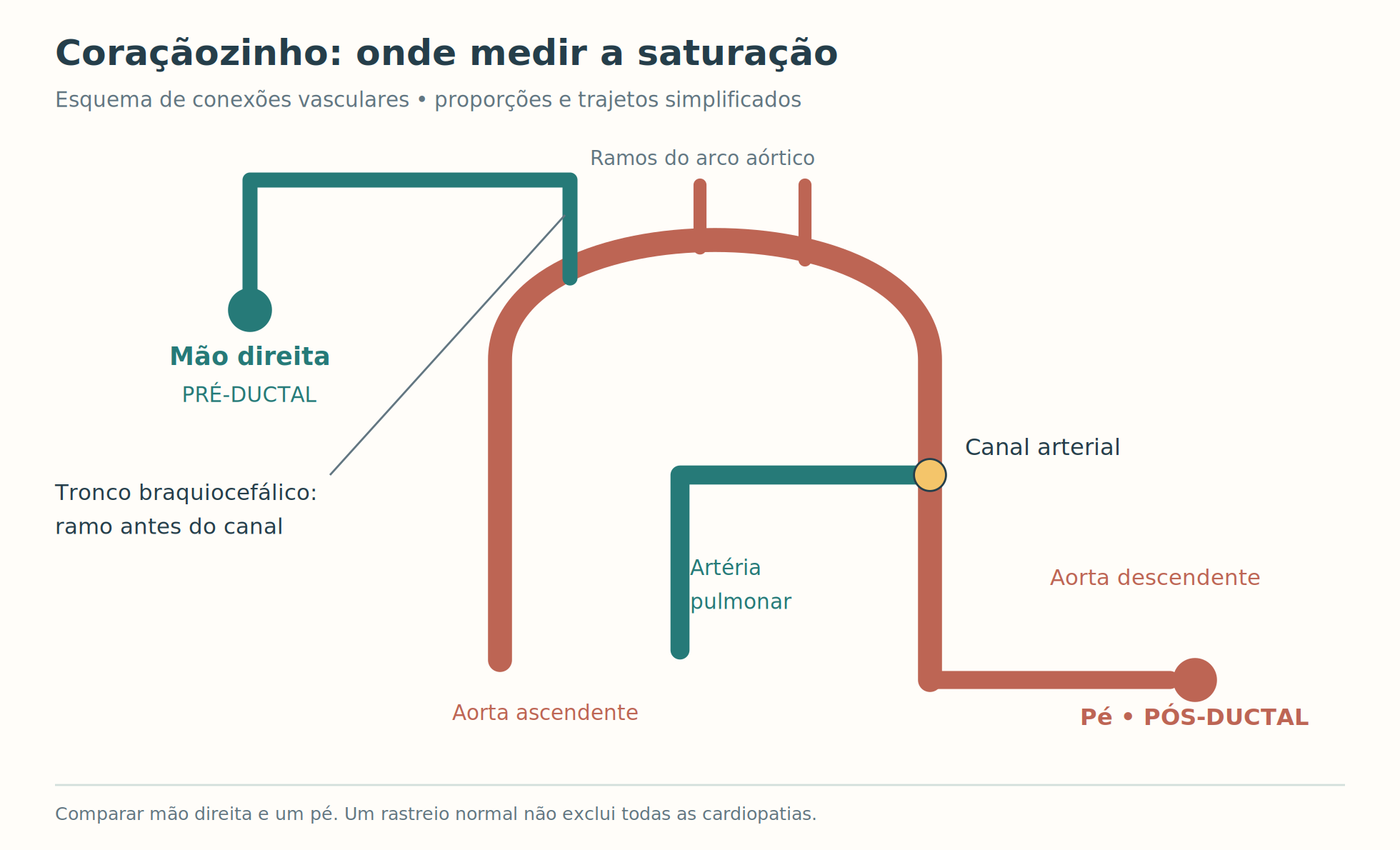 Conexões entre arco aórtico, mão direita, canal arterial e aorta descendente até o pé.
